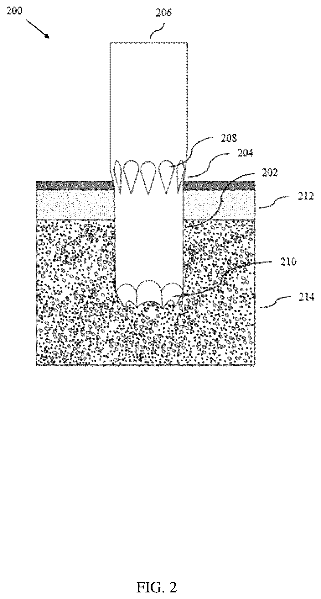 Patent US12611204 Figure 2 – Bone marrow aspiration and trephine biopsy single needle assembly