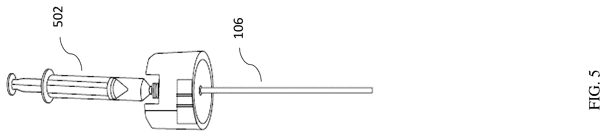 Patent US12611204 Figure 5 – Bone marrow aspiration and trephine biopsy single needle assembly