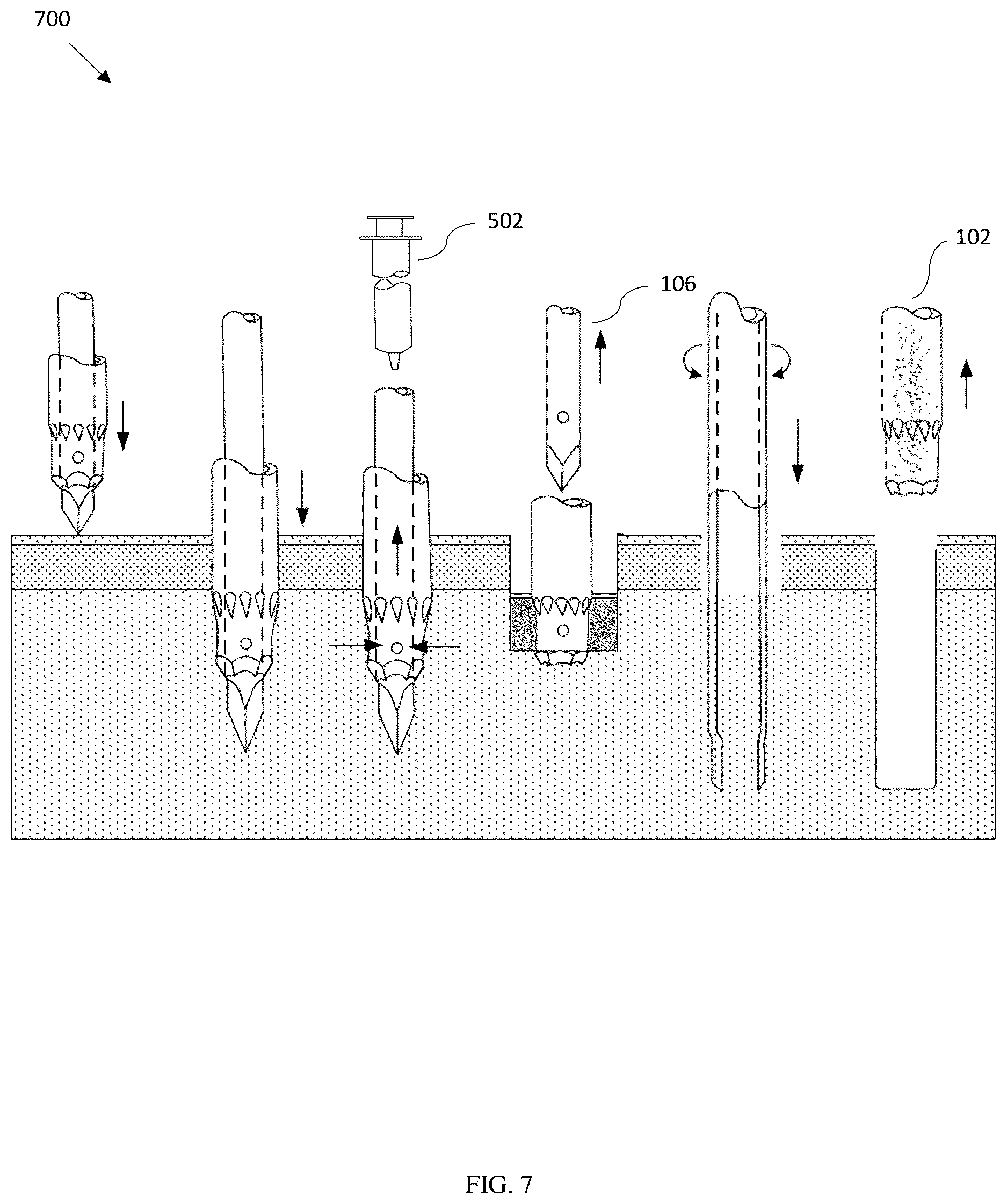 Patent US12611204 Figure 7 – Bone marrow aspiration and trephine biopsy single needle assembly
