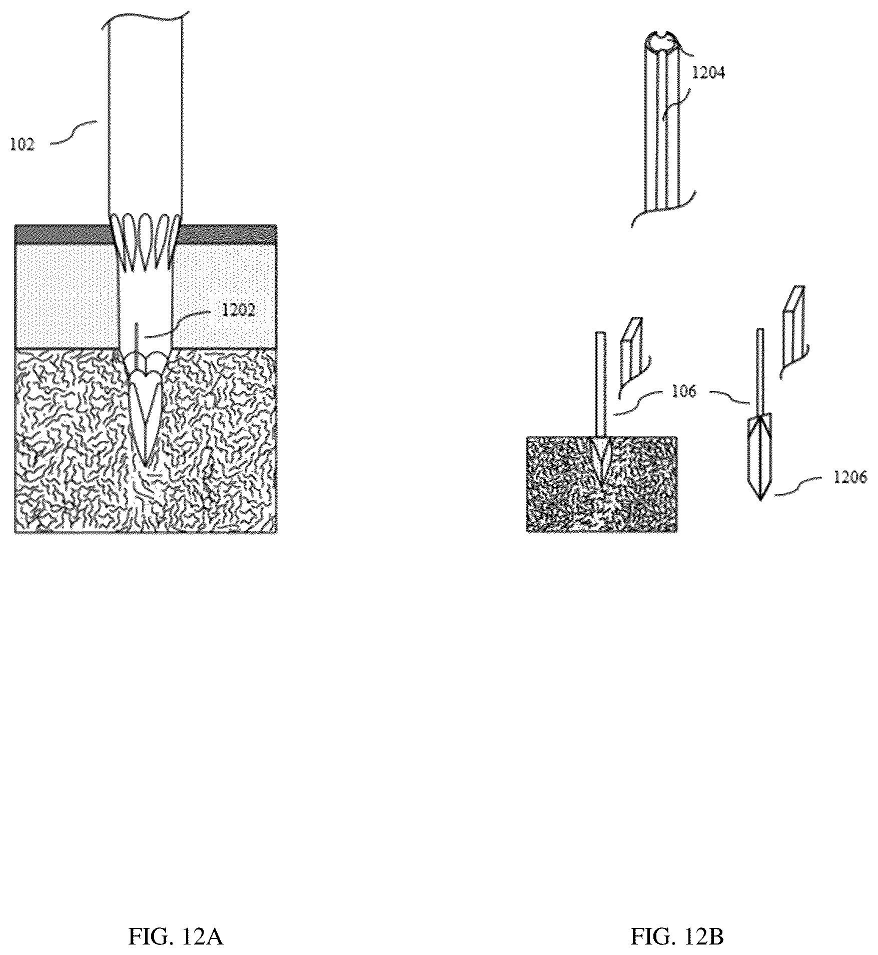 Patent US12611204 Figure 12 – Bone marrow aspiration and trephine biopsy single needle assembly