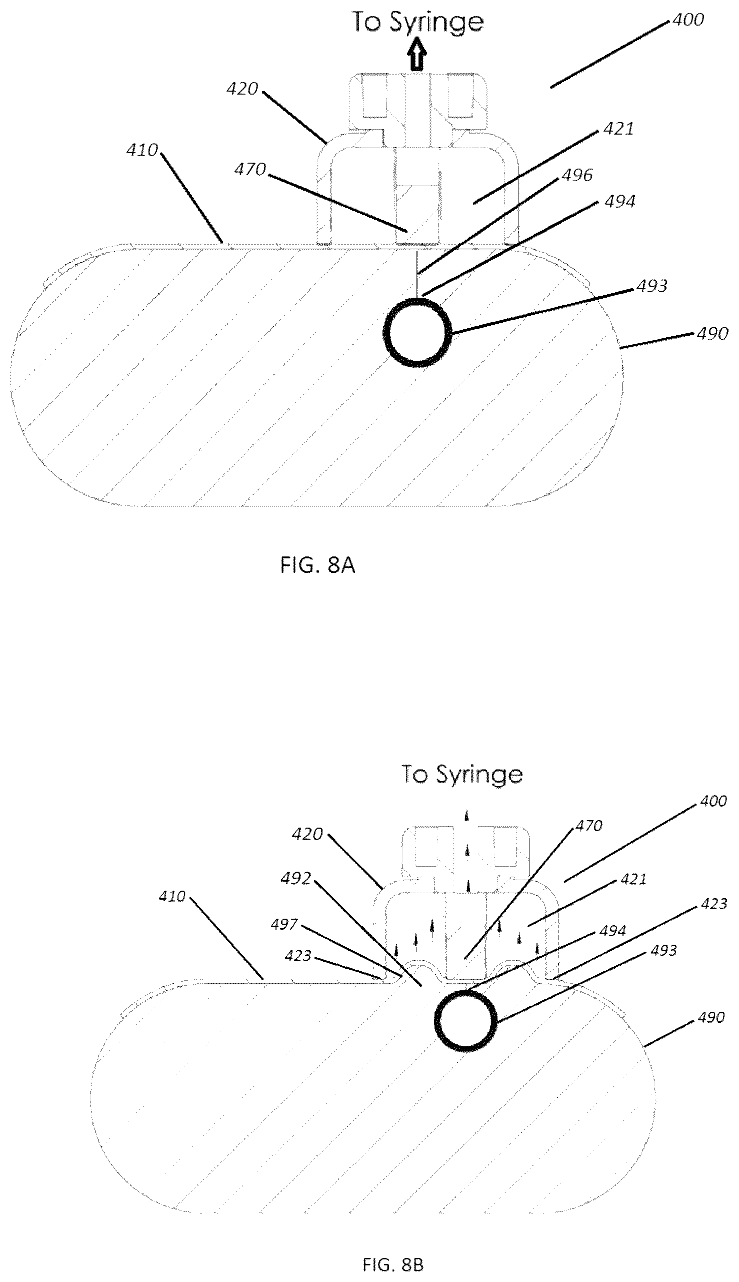 Patent US12611206 Figure 9 – Positive displacement closure devices and methods