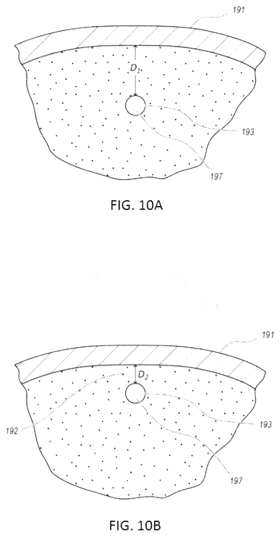 Patent US12611206 Figure 11 – Positive displacement closure devices and methods