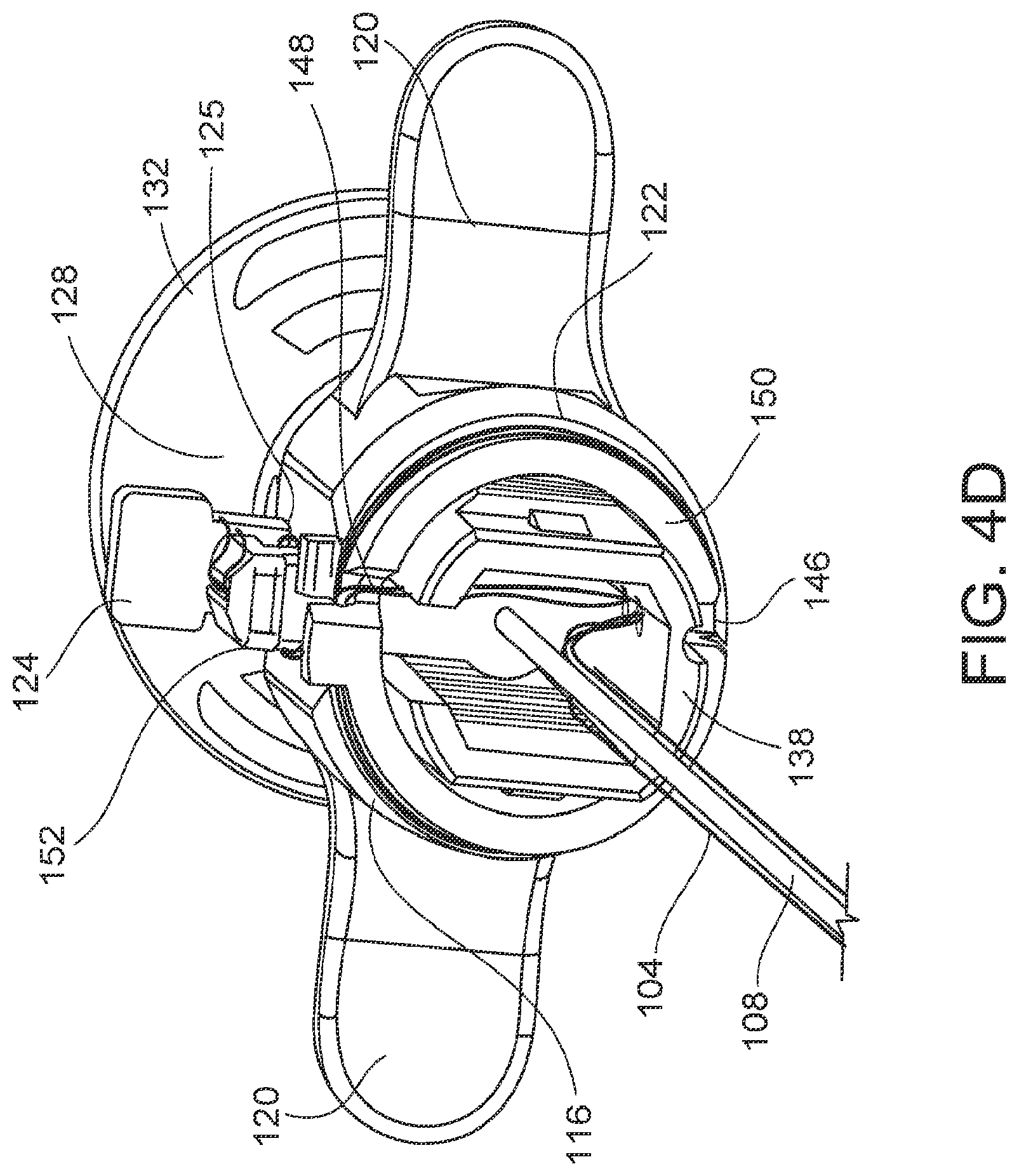 Patent US12611207 Figure 7 – Flexible anchor delivery system
