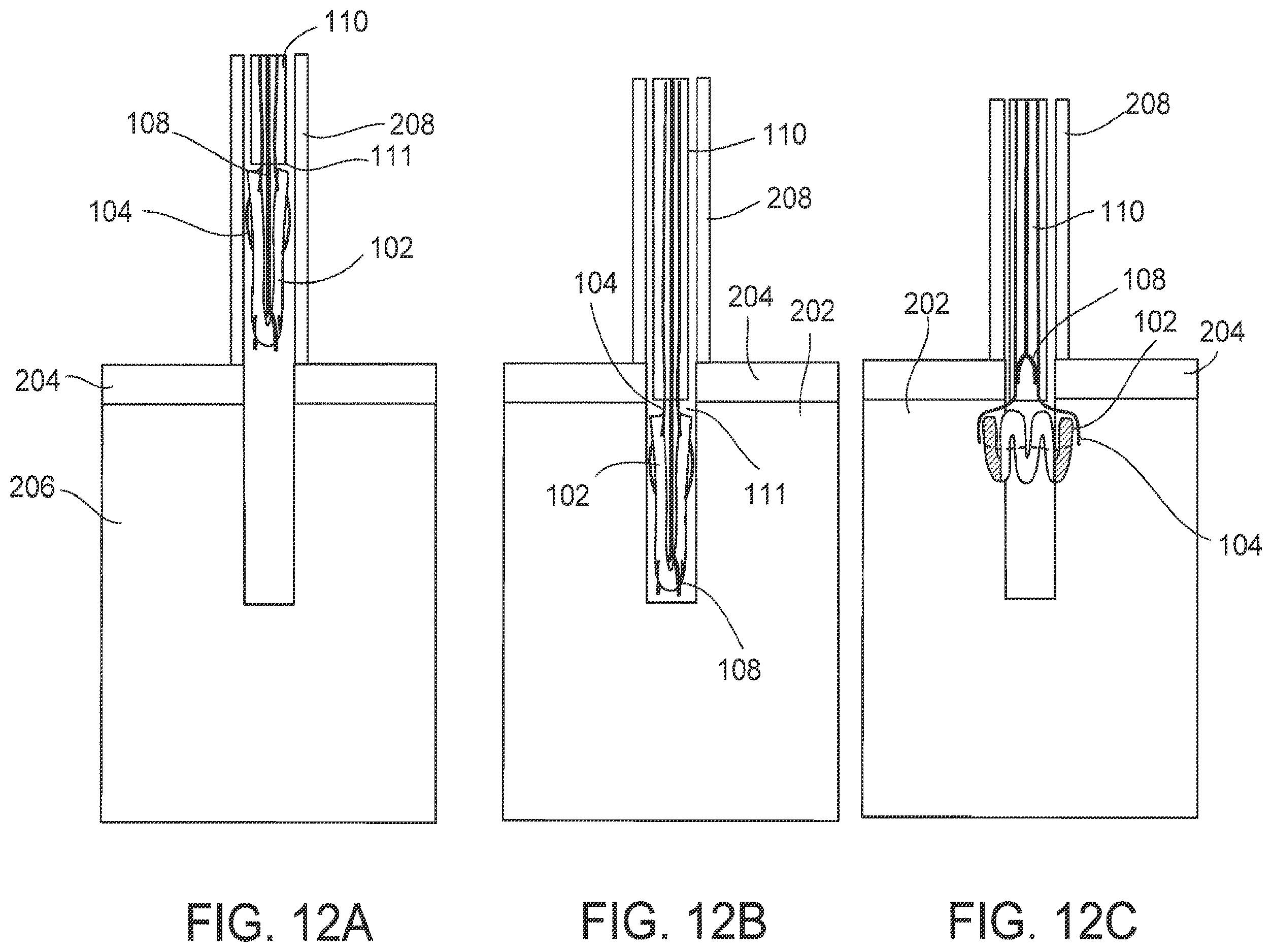 Patent US12611207 Figure 19 – Flexible anchor delivery system