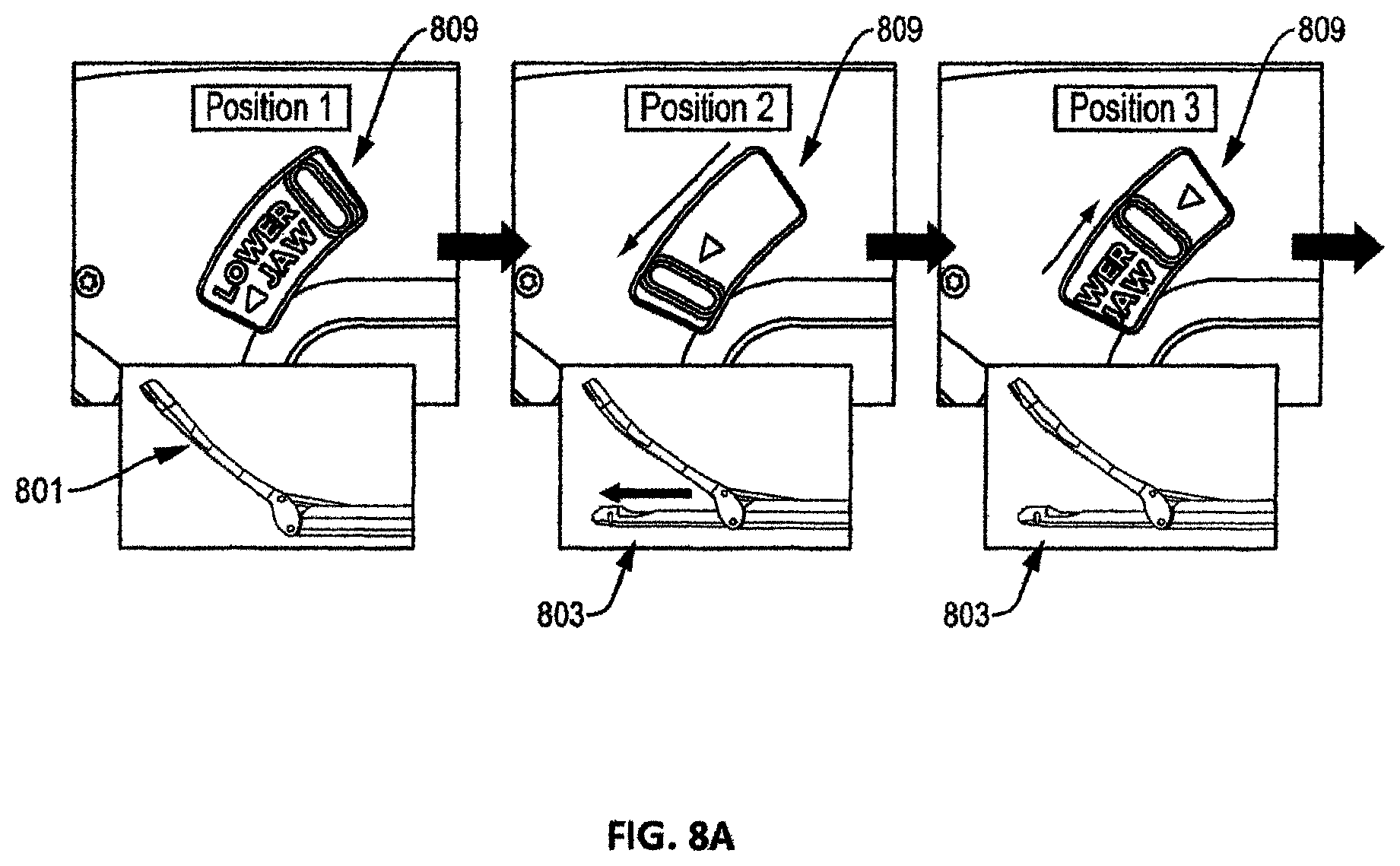 Patent US12611208 Figure 12 – Suture passer devices and methods