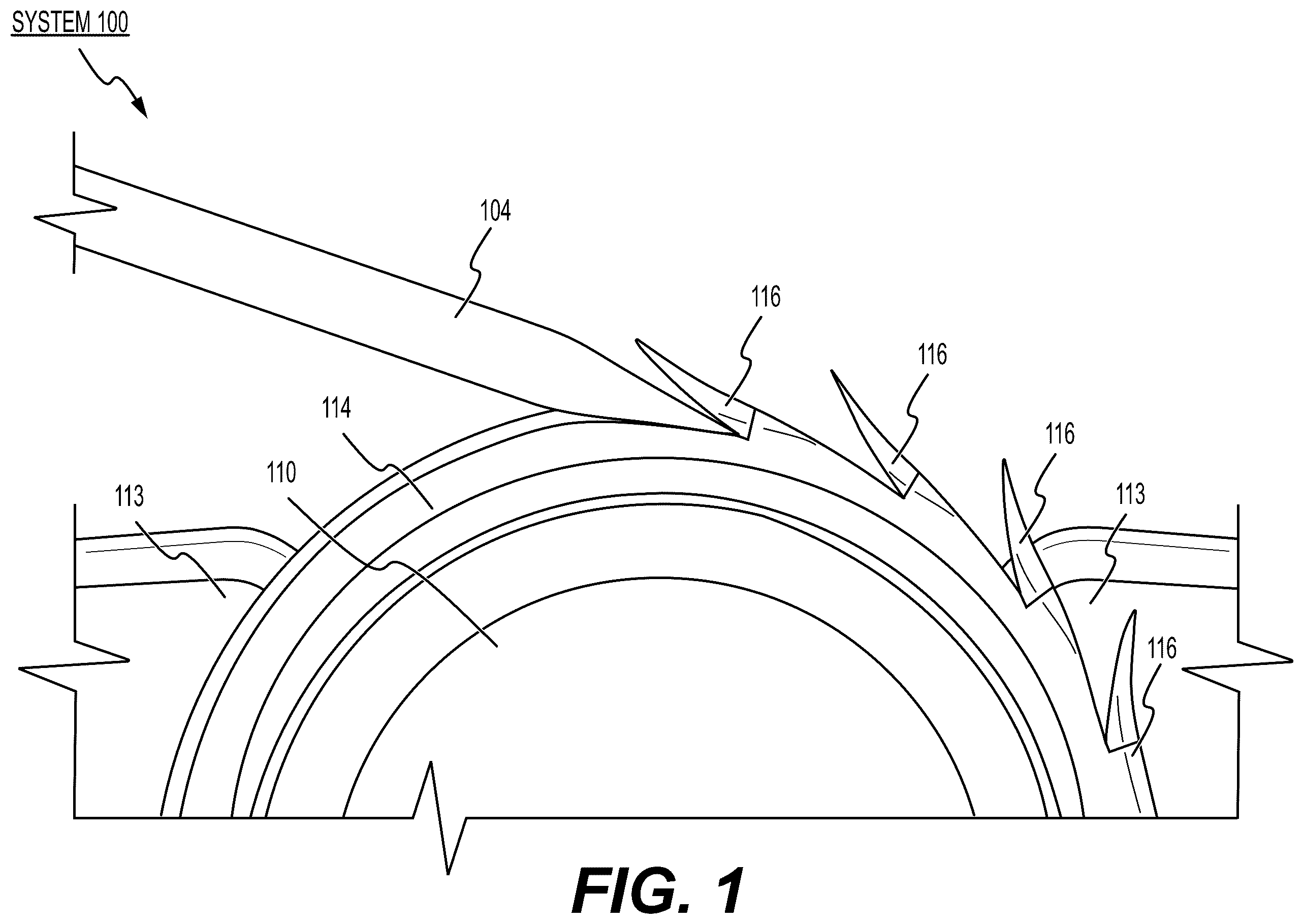 Patent US12611210 Figure 1 – Method and system for manufacturing a barbed suture