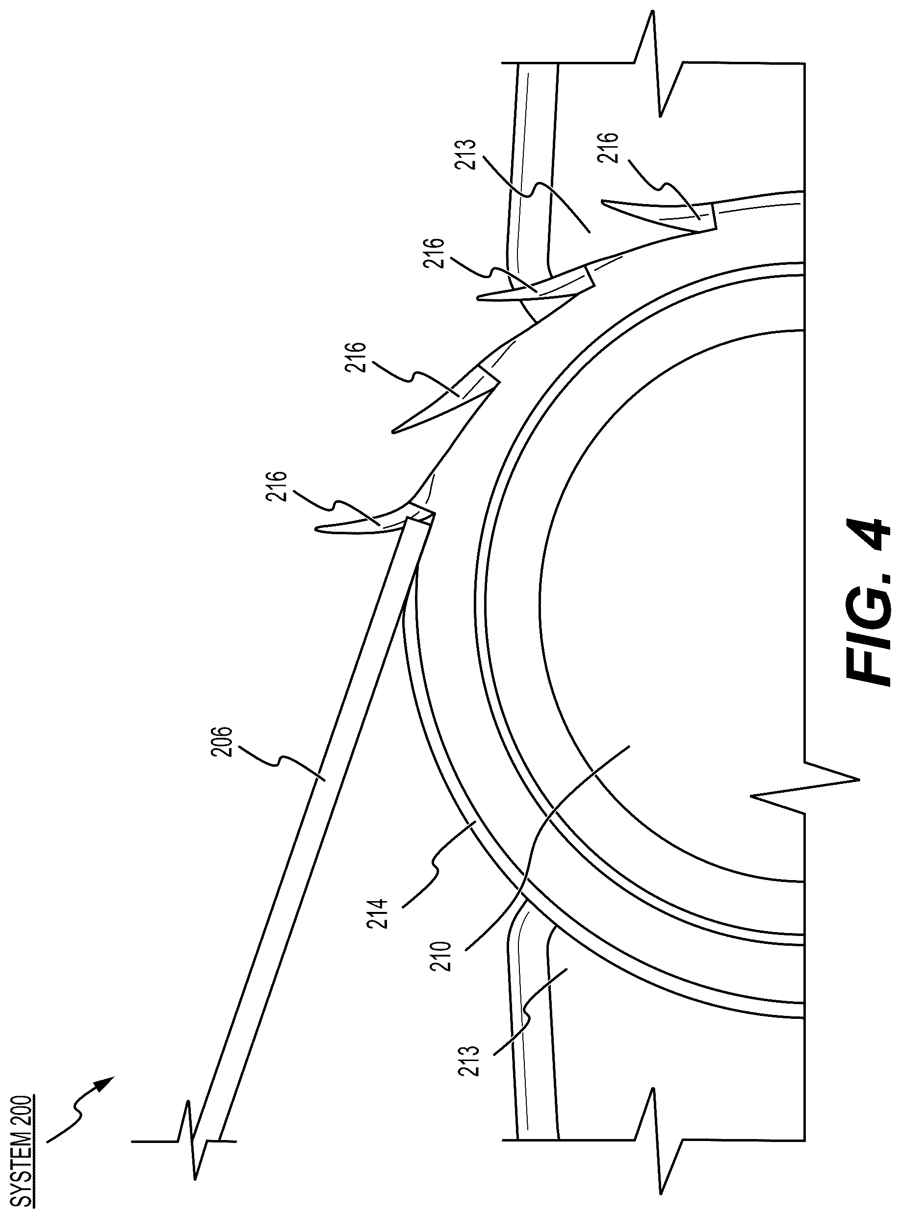 Patent US12611210 Figure 4 – Method and system for manufacturing a barbed suture