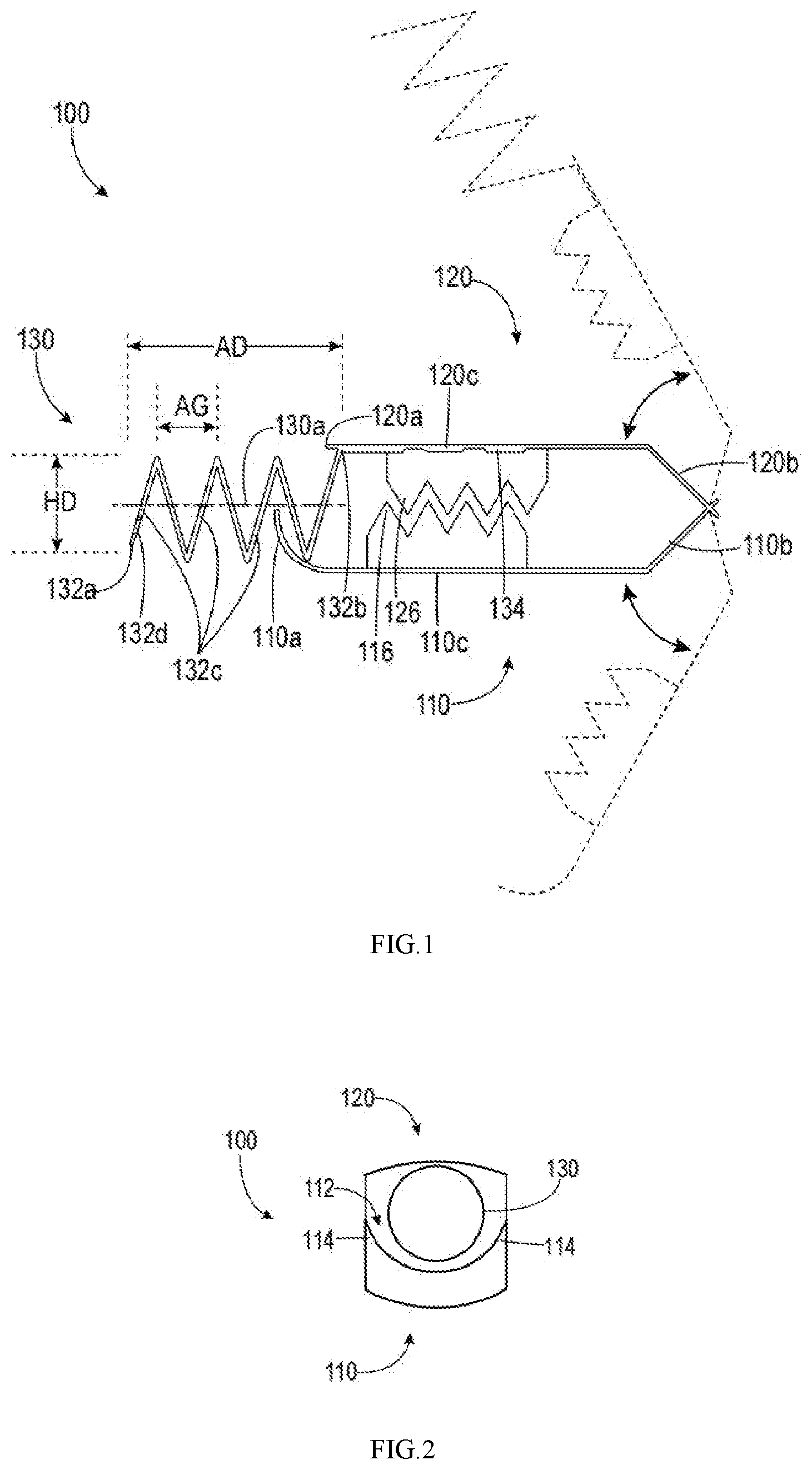 Patent US12611215 Figure 1 – Endoscopic clip