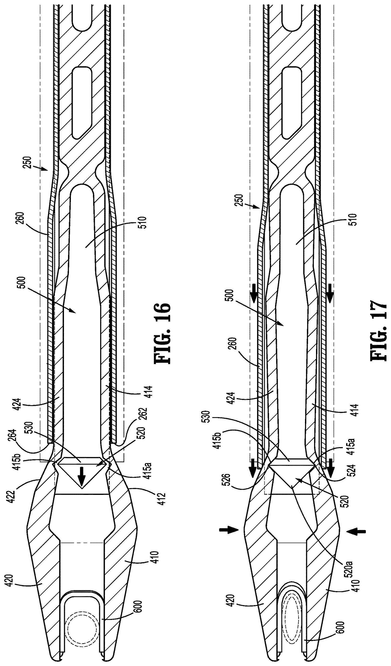 Patent US12611216 Figure 11 – Partial clip closure mechanisms for surgical clip appliers and surgical clip appliers incorporating the same