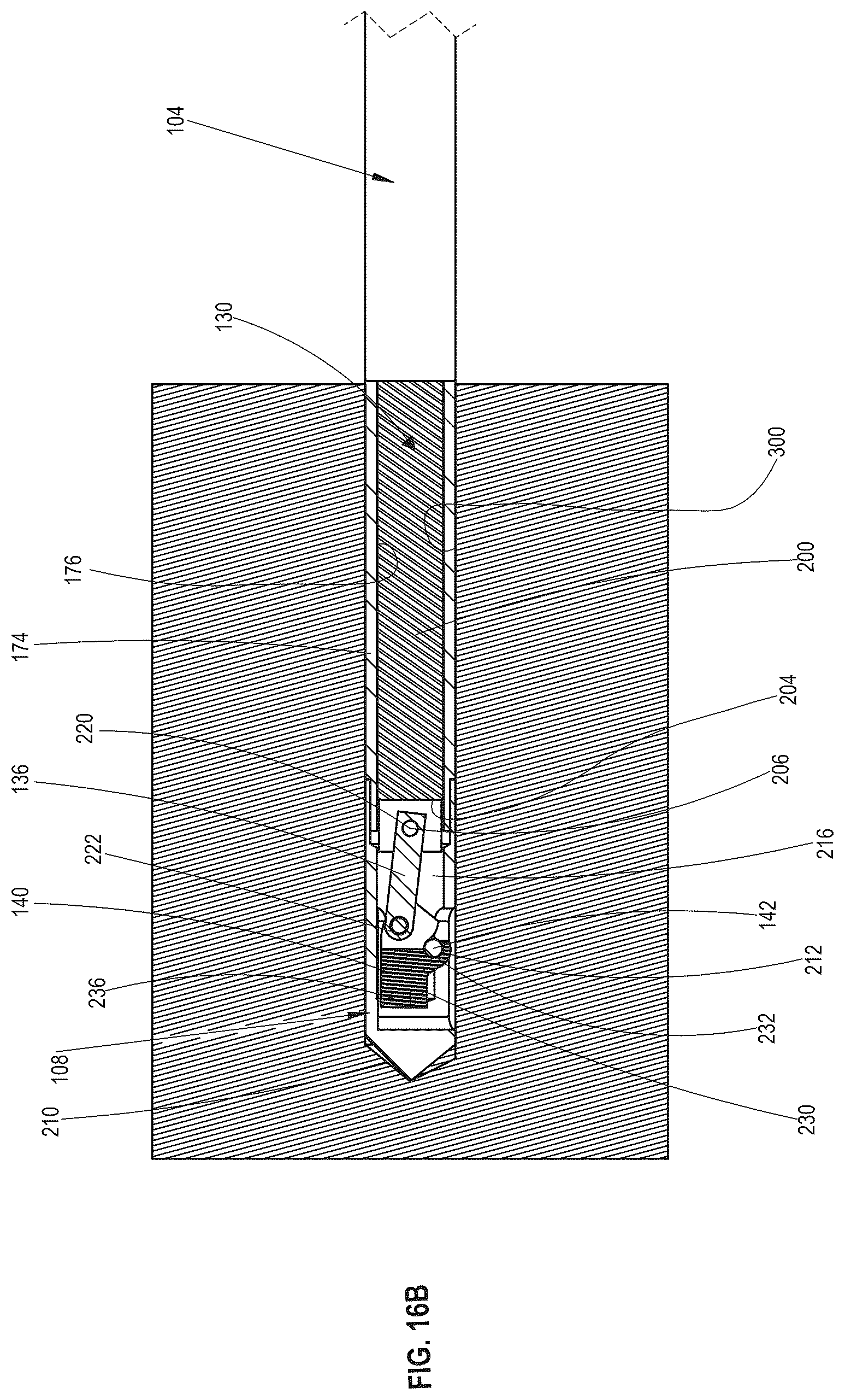 Patent US12611217 Figure 17 – Bone material removal device and a method for use thereof
