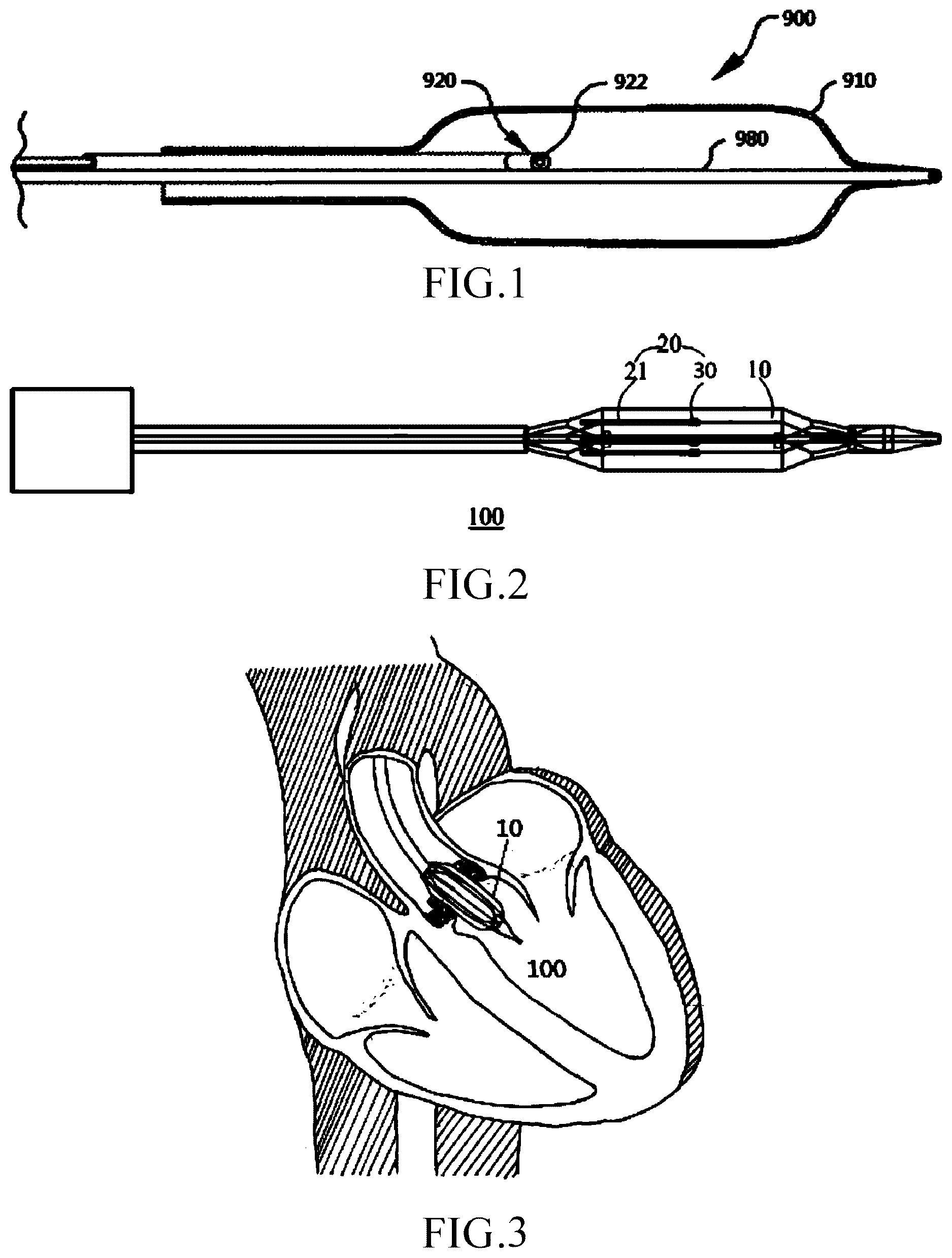 Patent US12611219 Figure 1 – Electrode assembly and shock wave apparatus using the electrode assembly
