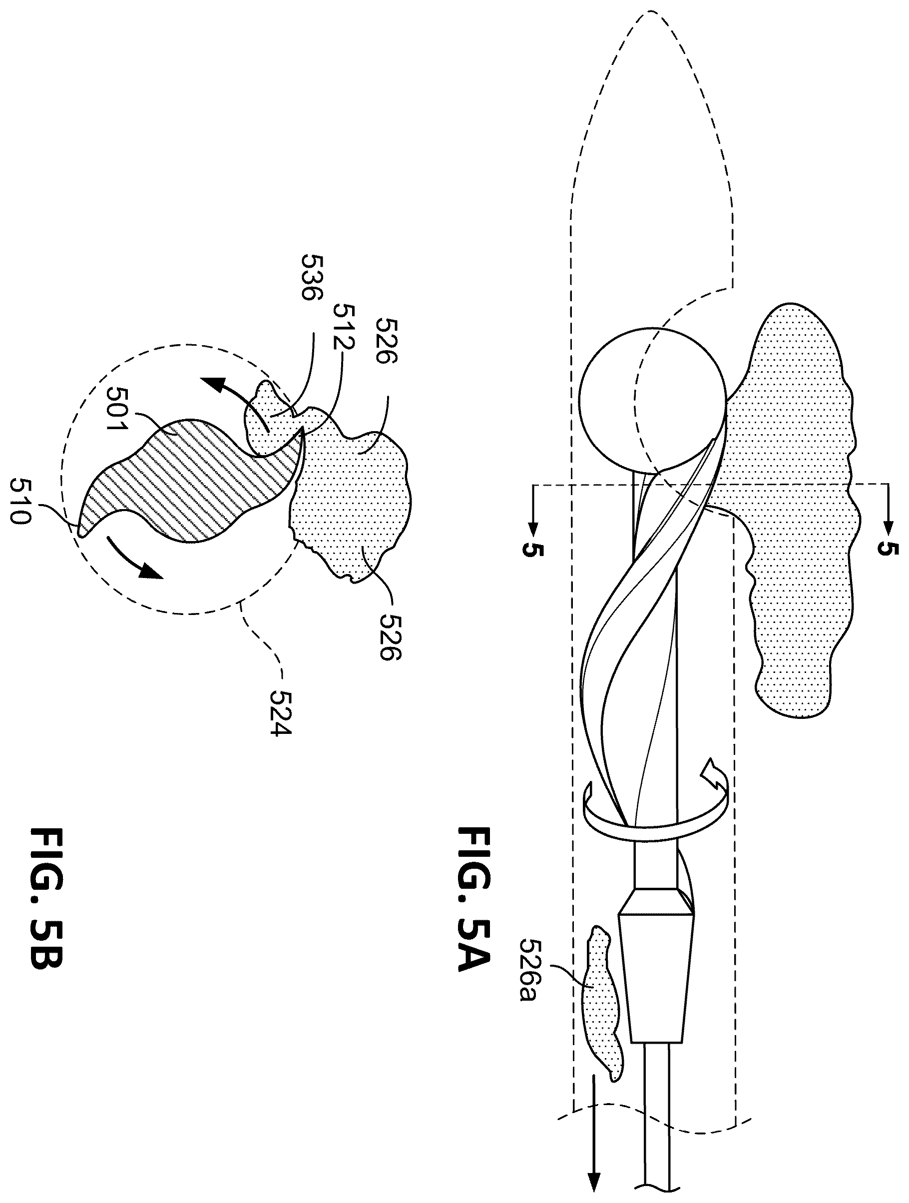 Patent US12611224 Figure 5 – Vascular occlusion detection from motorized separator torque measurement signal