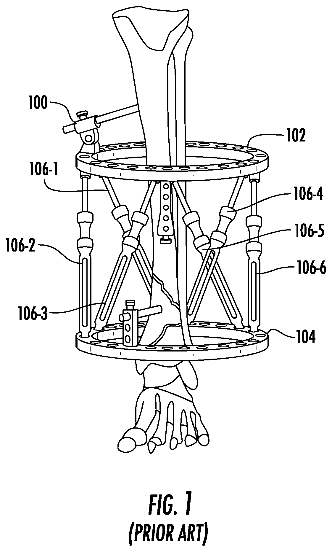 Patent US12611228 — Detachable geared-motor assembly for motorizing a strut in a spatial frame — Figure 1