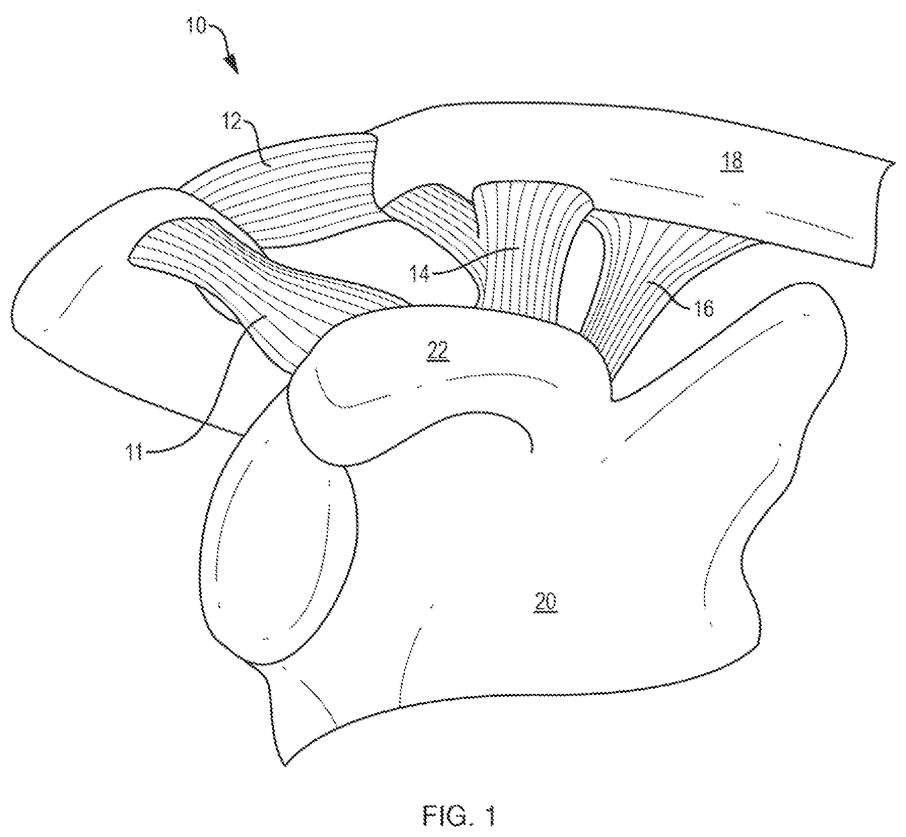 Patent US12611230 Figure 1 – Methods and systems related to joint repair