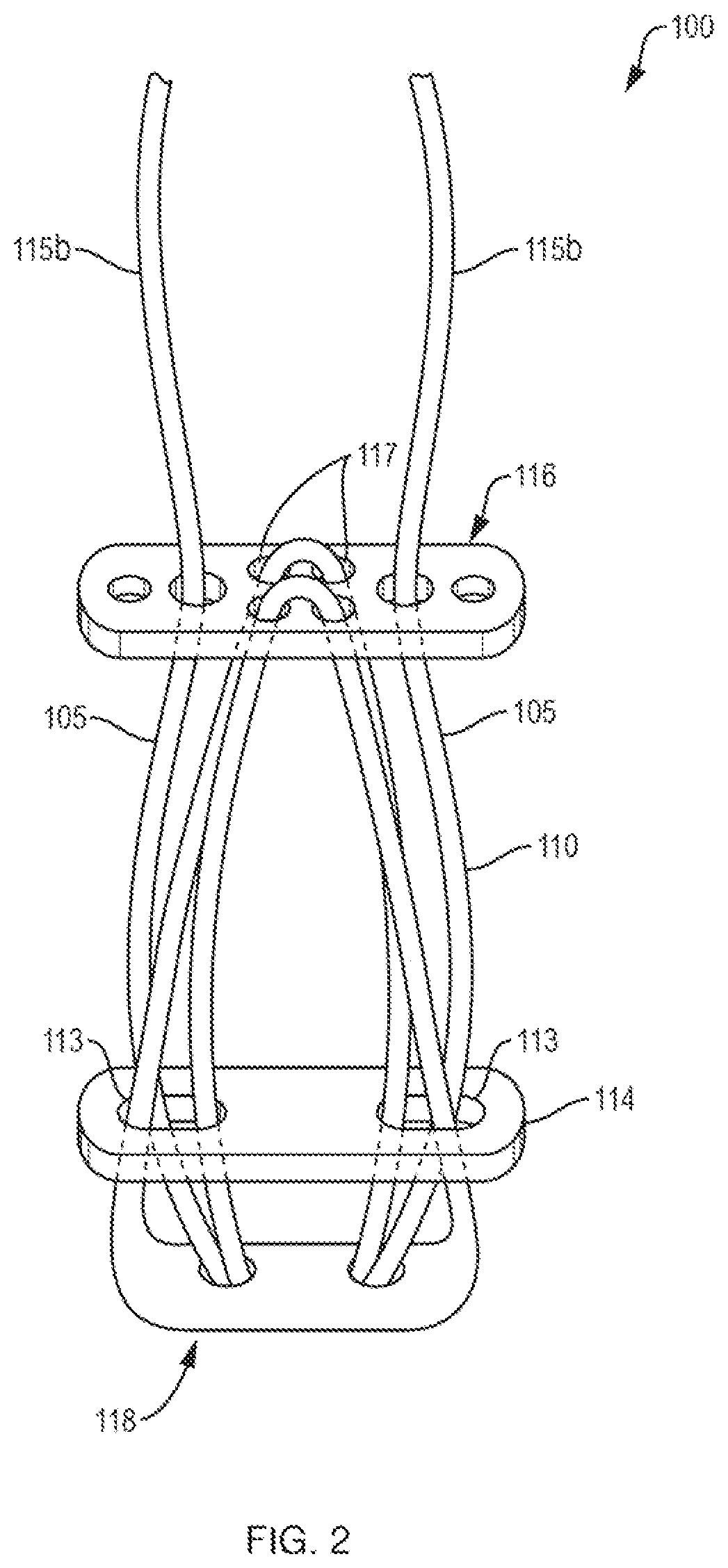 Patent US12611230 Figure 2 – Methods and systems related to joint repair