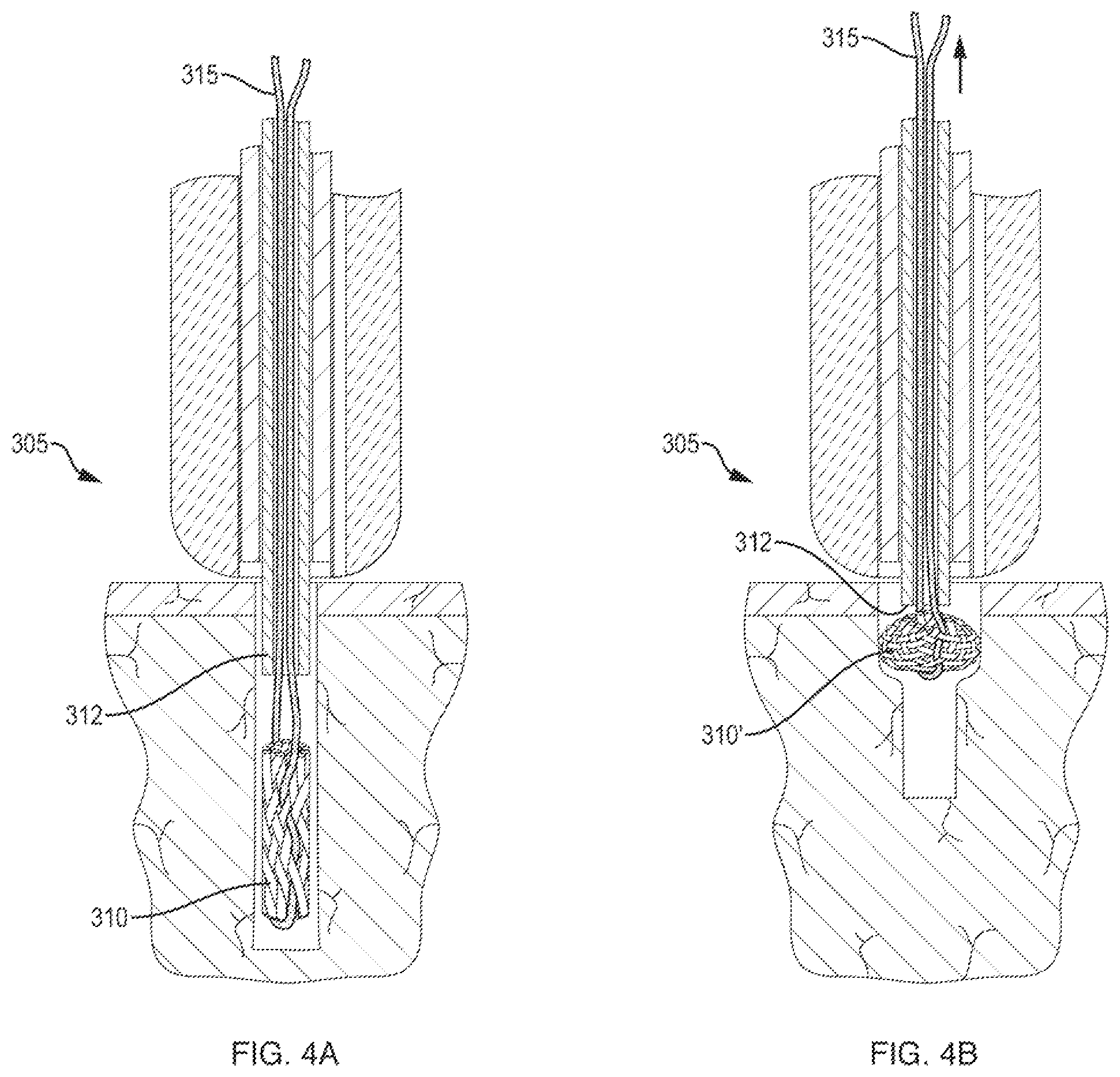 Patent US12611230 Figure 4 – Methods and systems related to joint repair