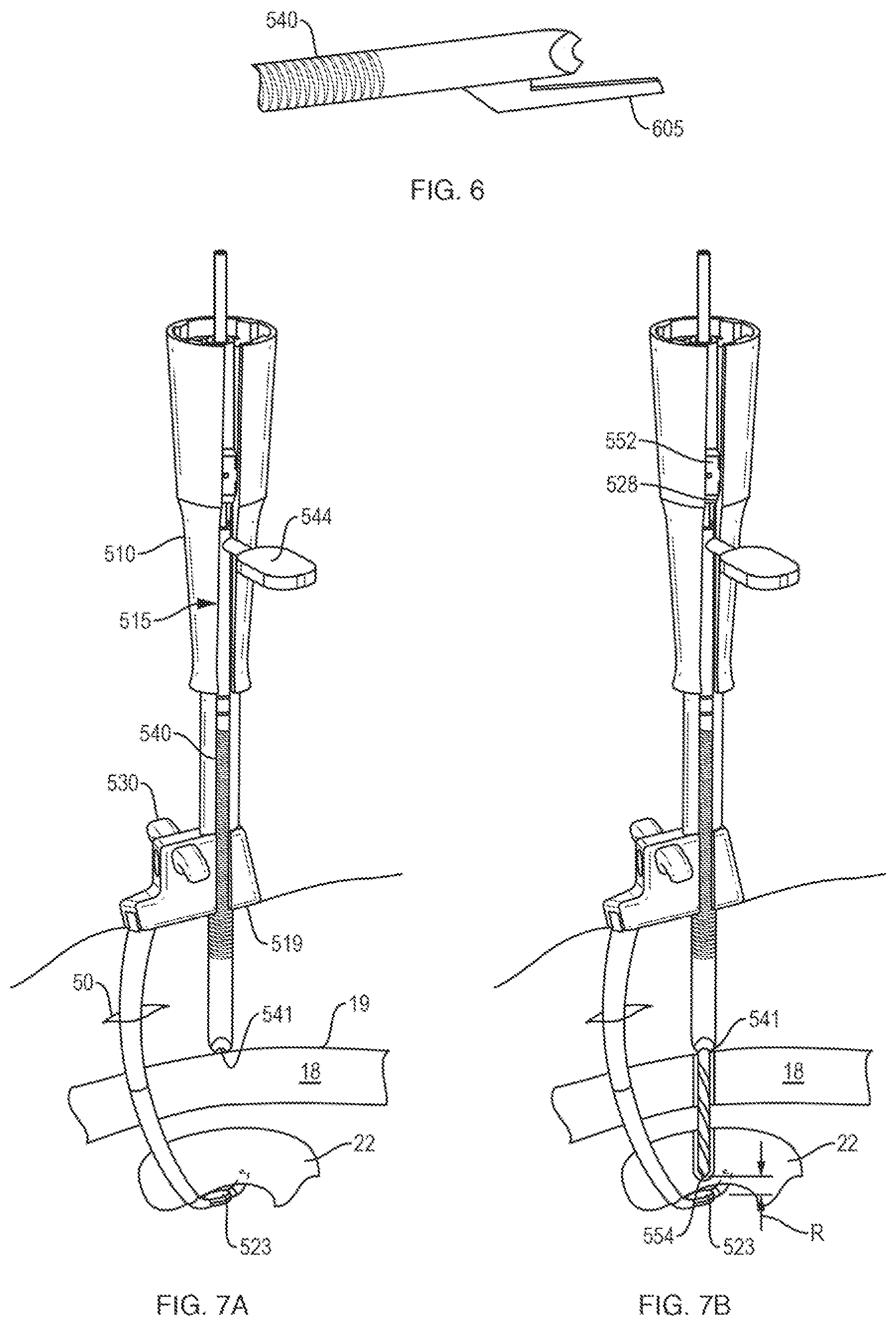 Patent US12611230 Figure 10 – Methods and systems related to joint repair