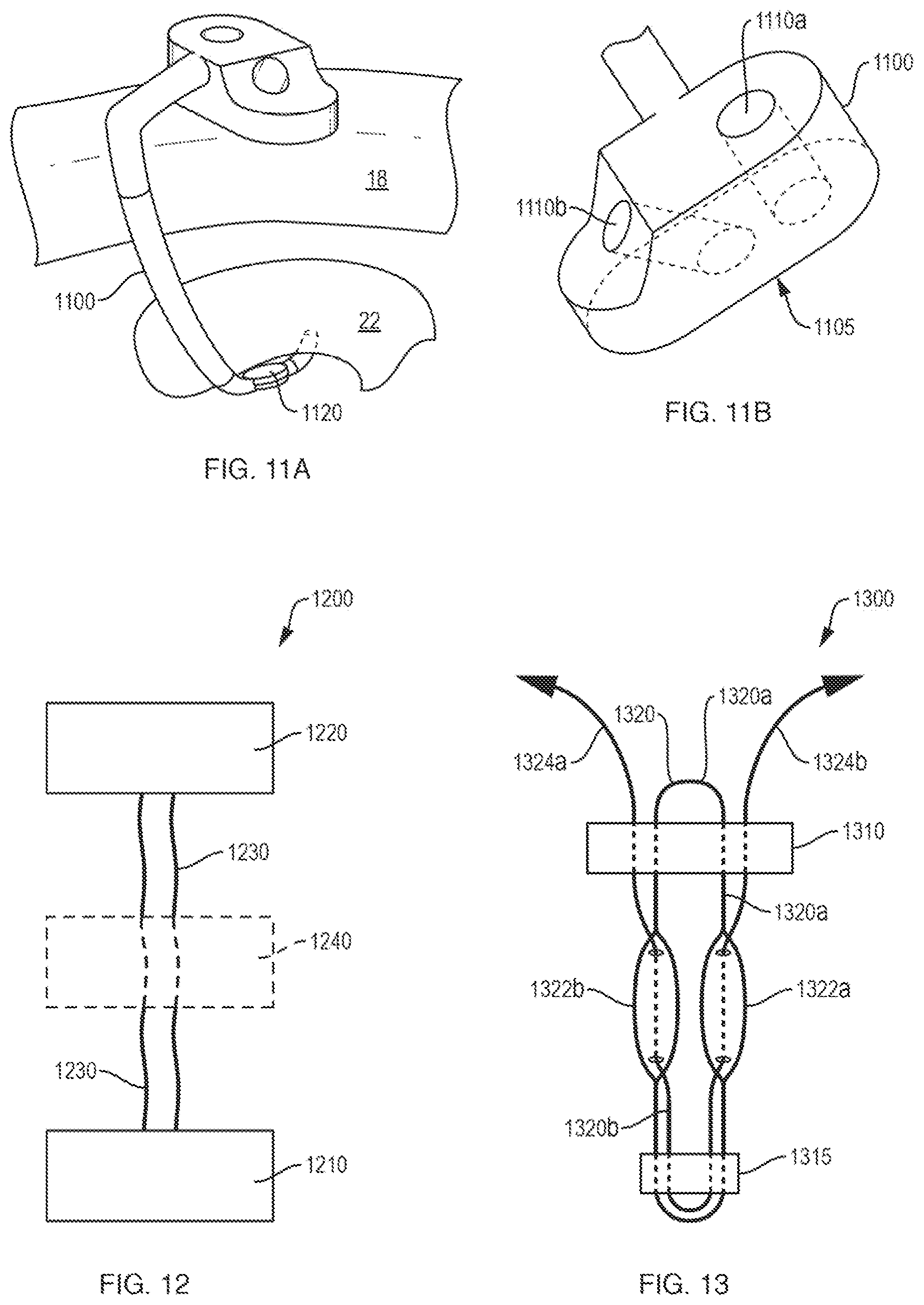 Patent US12611230 Figure 15 – Methods and systems related to joint repair