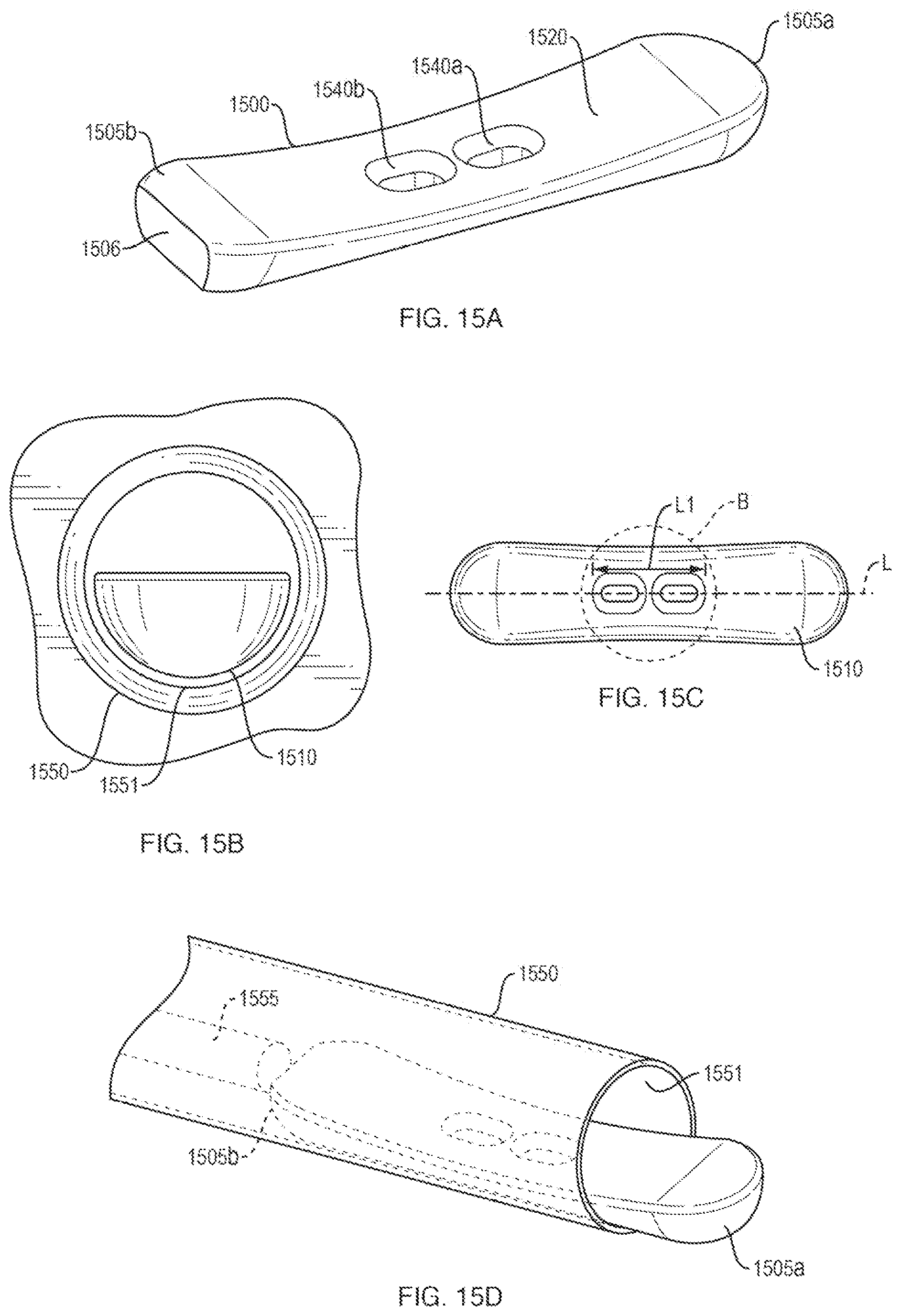 Patent US12611230 Figure 17 – Methods and systems related to joint repair