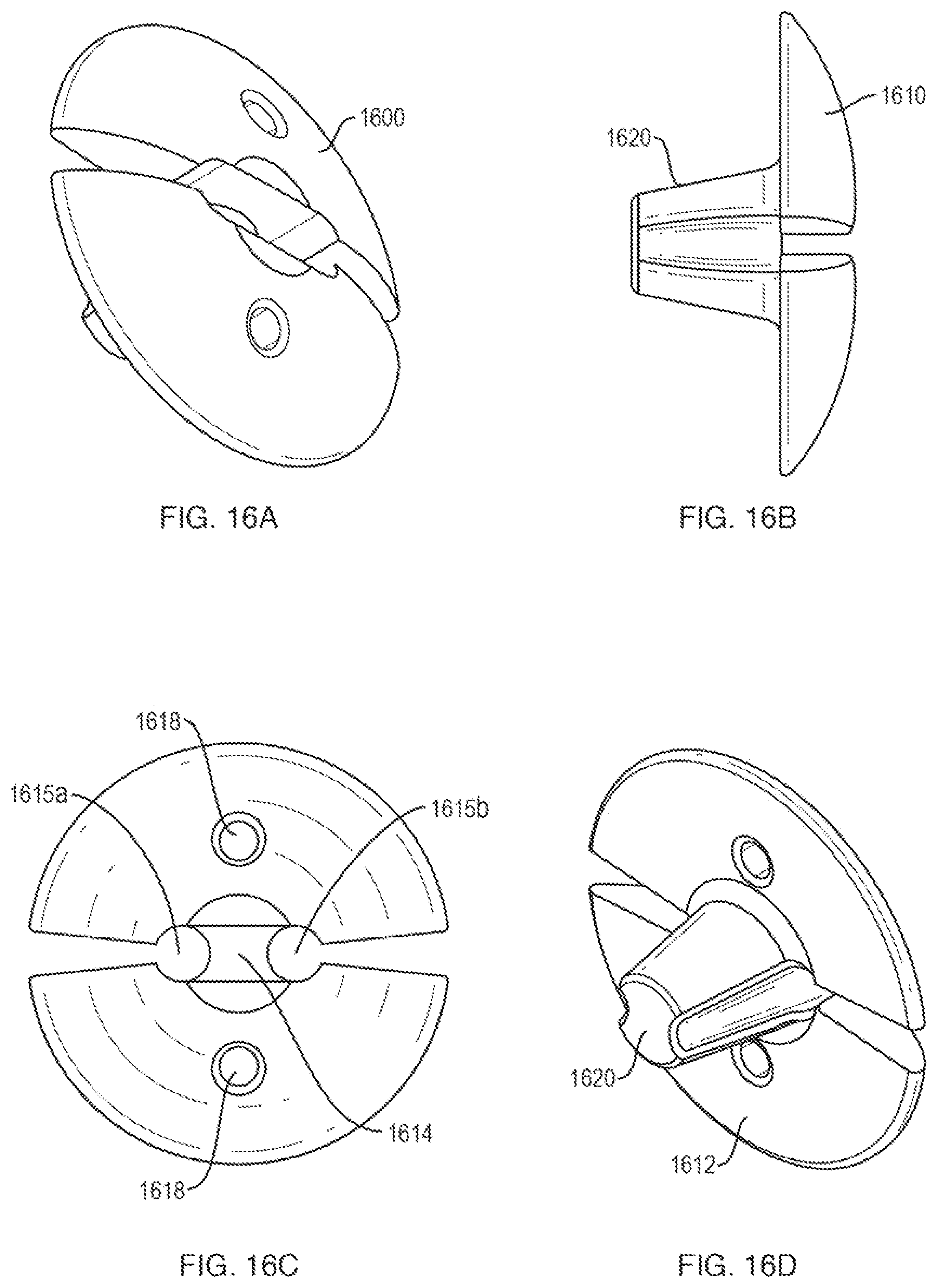 Patent US12611230 Figure 18 – Methods and systems related to joint repair