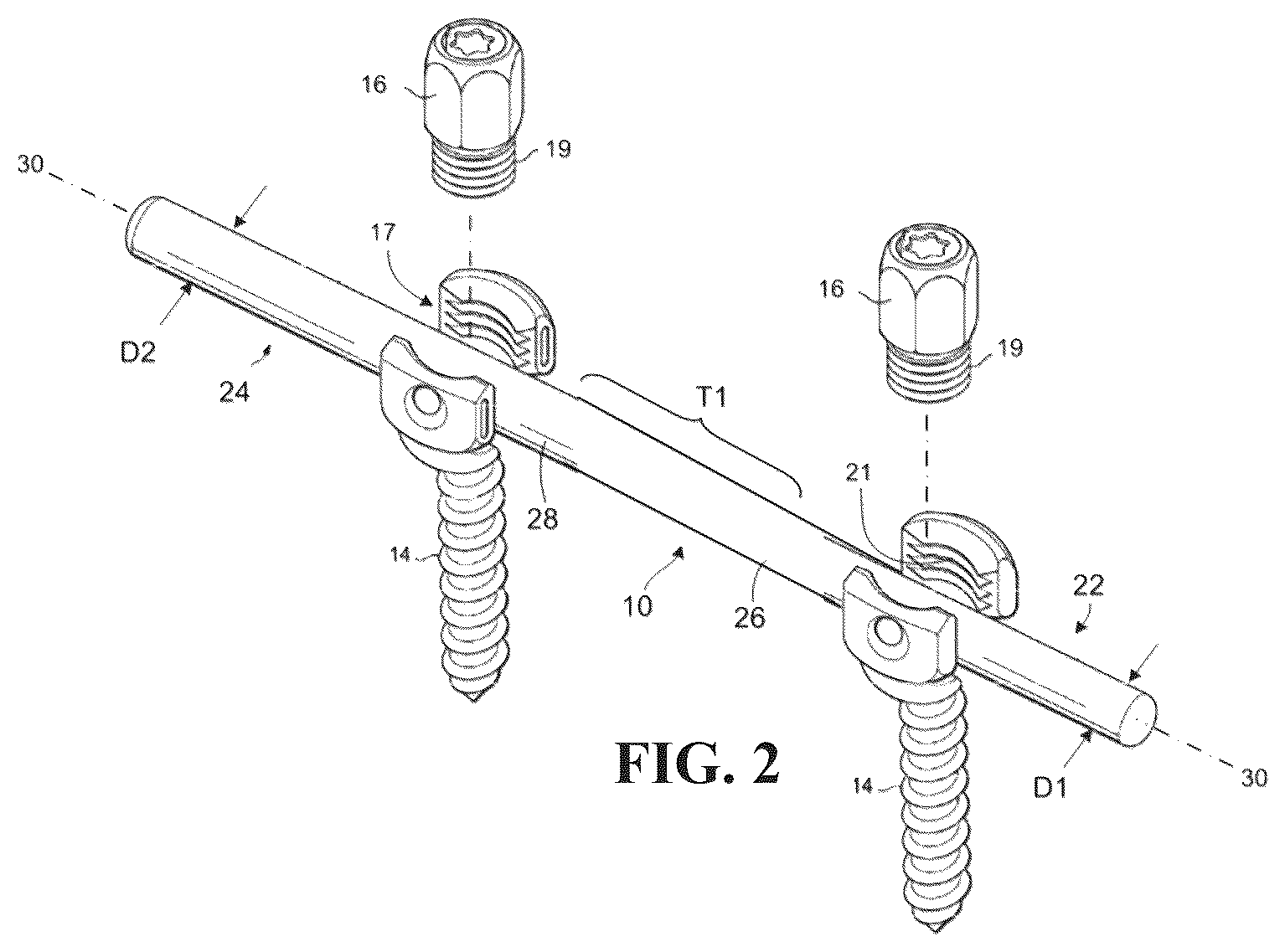 Patent US12611231 Figure 2 – Spinal rod and systems thereof