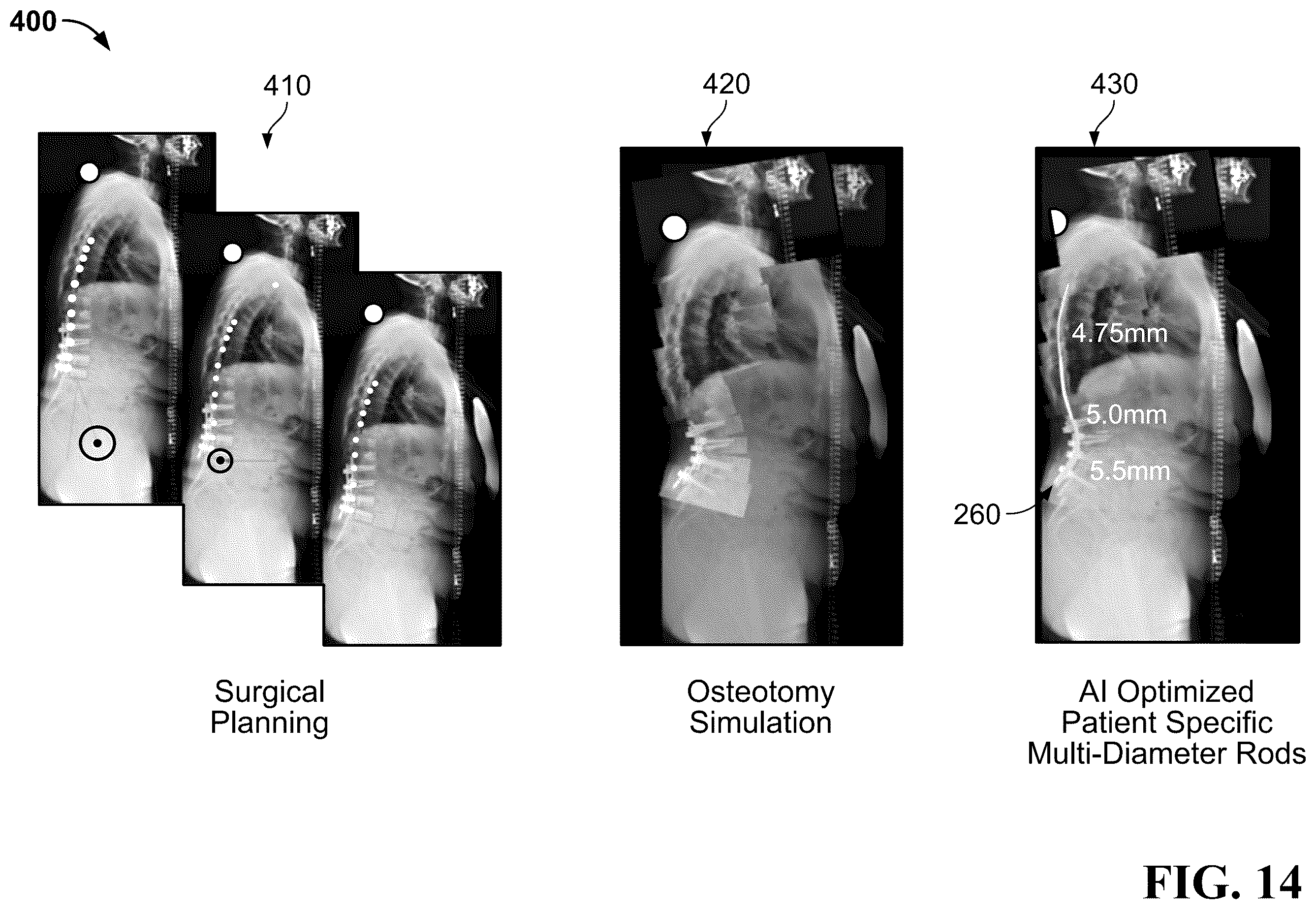 Patent US12611231 Figure 19 – Spinal rod and systems thereof