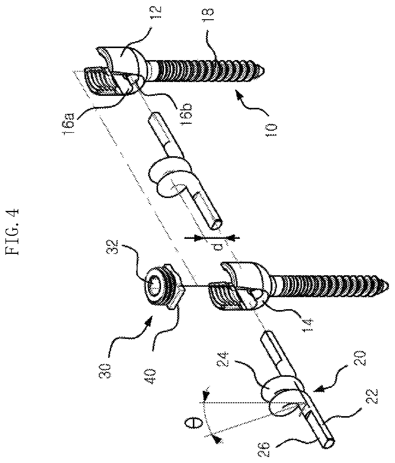 Patent US12611232 Figure 4 – Bio-flexible spinal fixation apparatus for preventing fatigue fracture