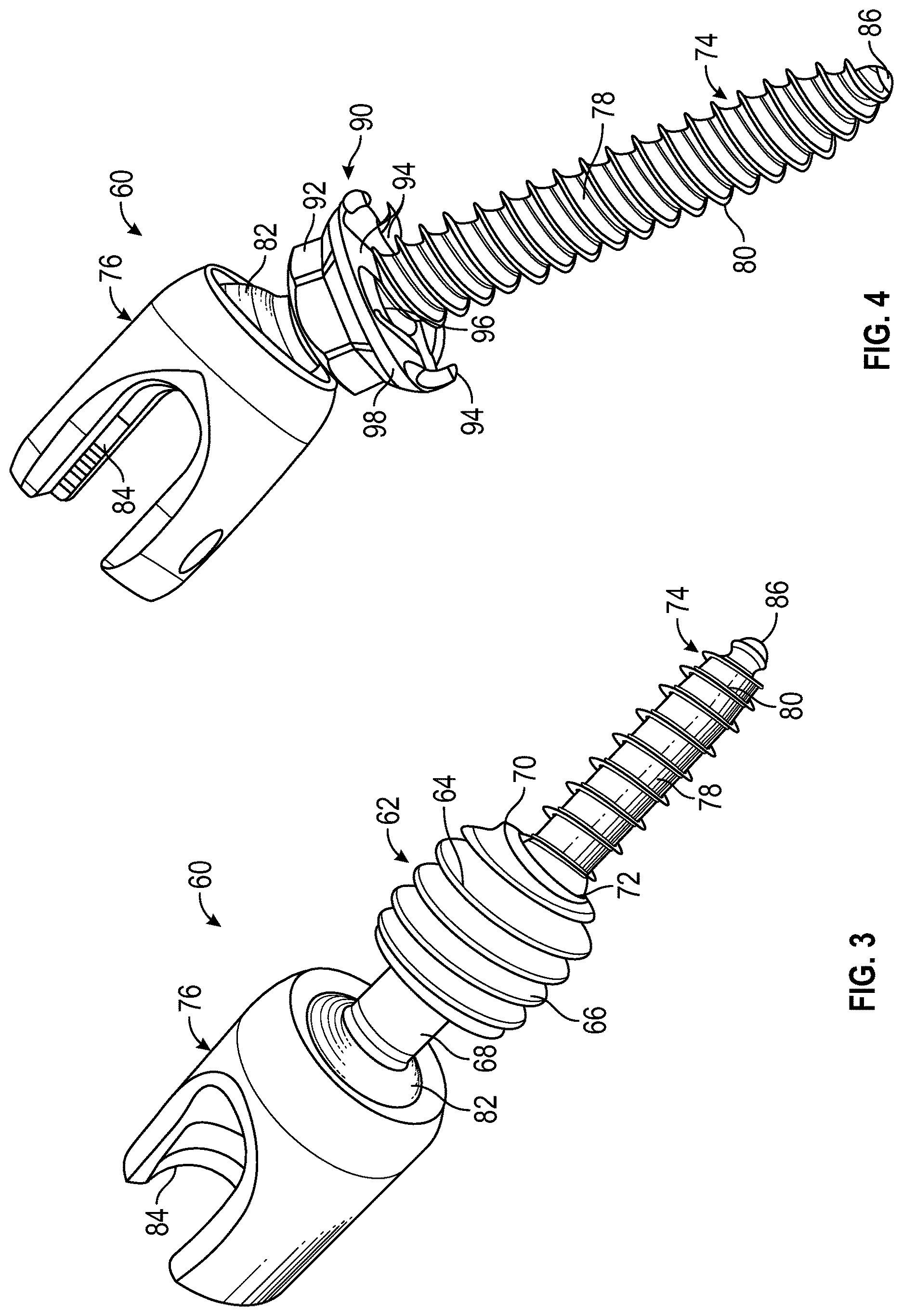 Patent US12611233 Figure 2 – Bone anchor housing limiter