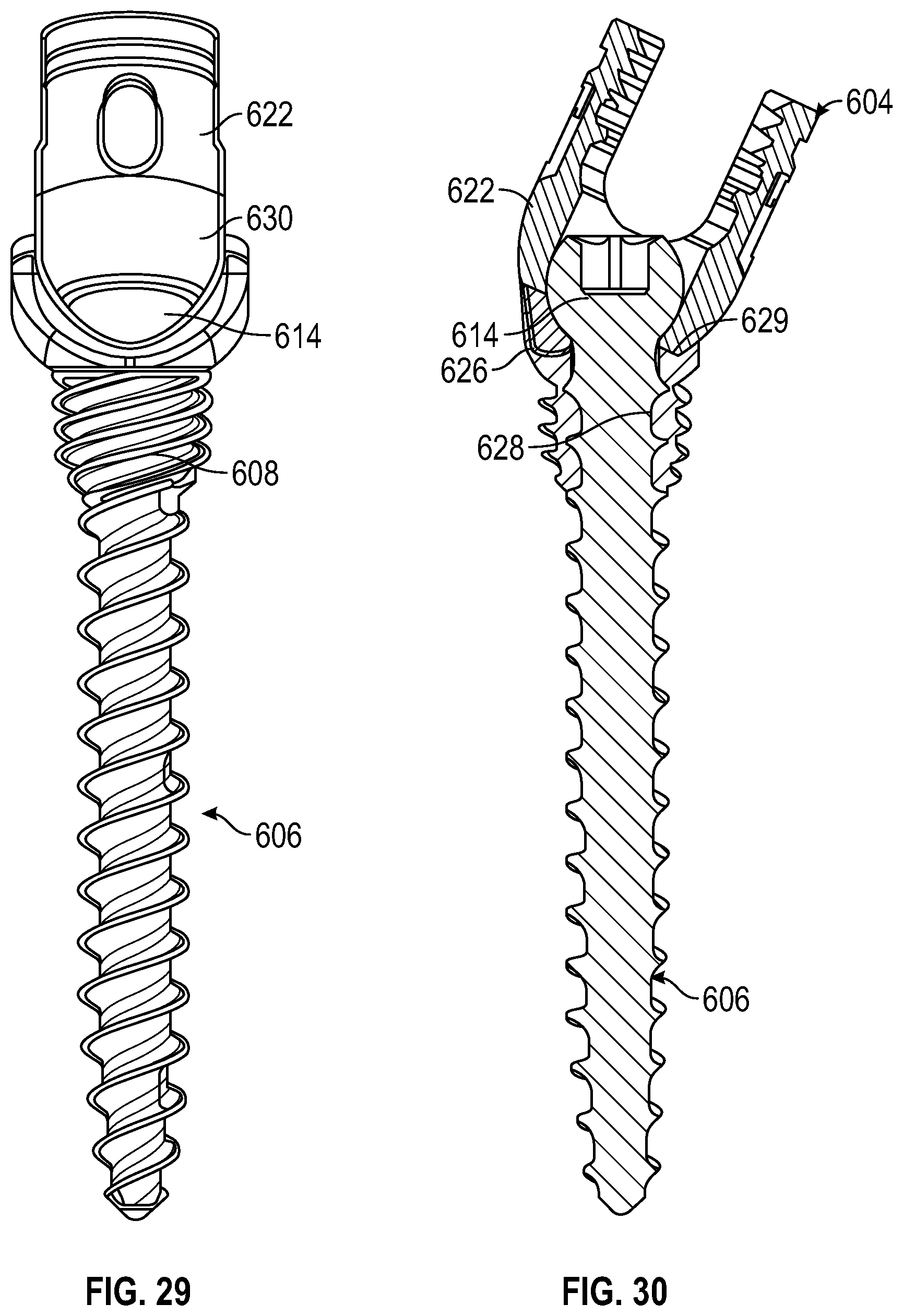 Patent US12611233 Figure 15 – Bone anchor housing limiter