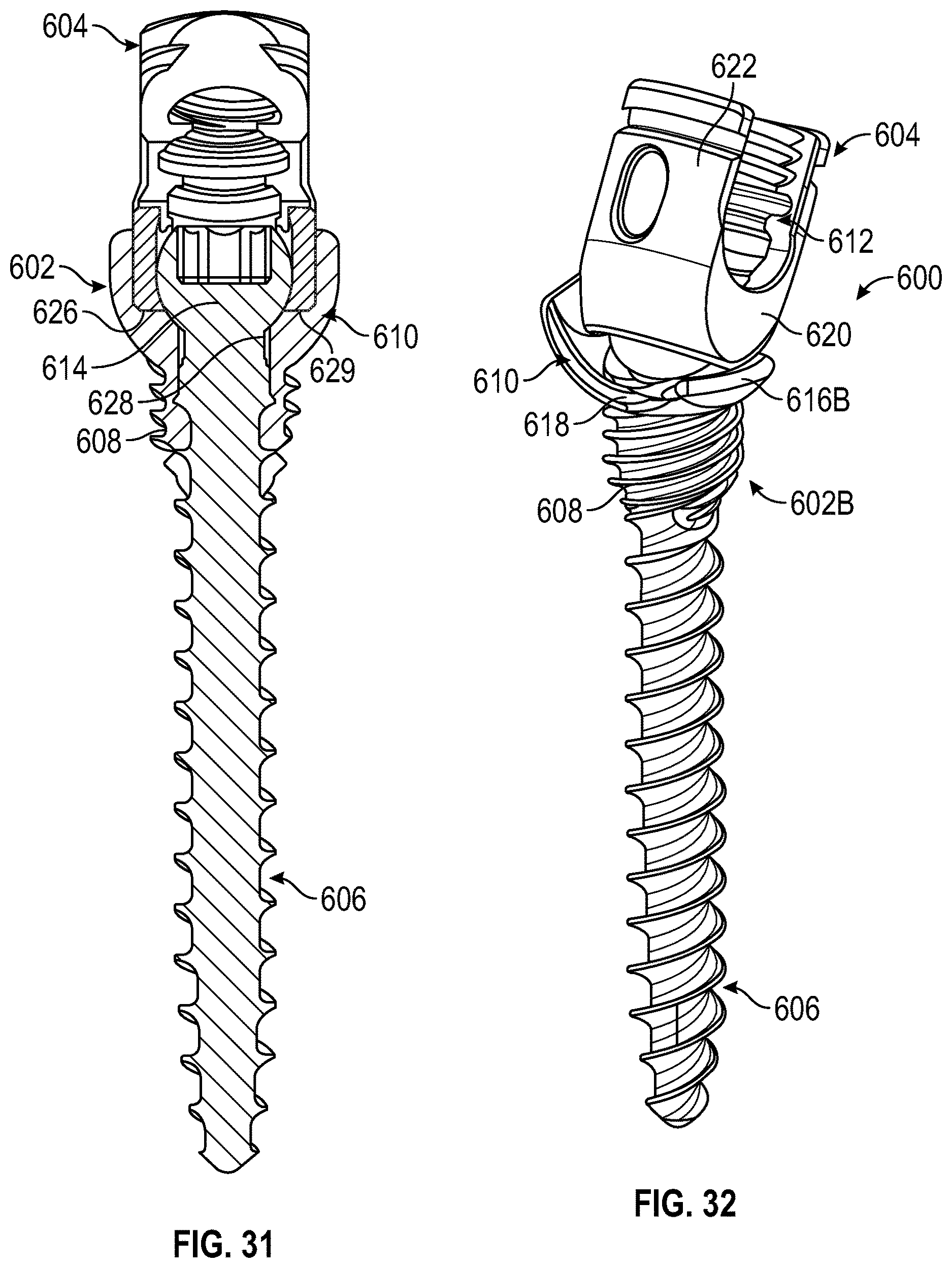 Patent US12611233 Figure 16 – Bone anchor housing limiter