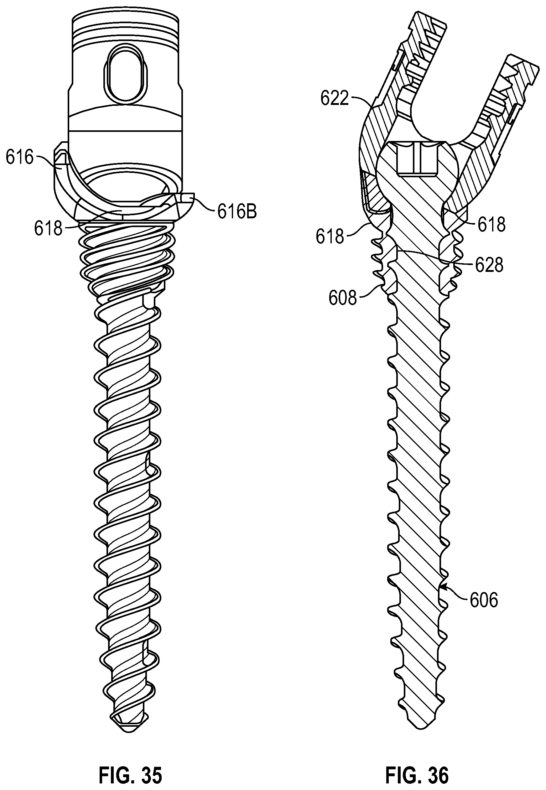 Patent US12611233 Figure 18 – Bone anchor housing limiter