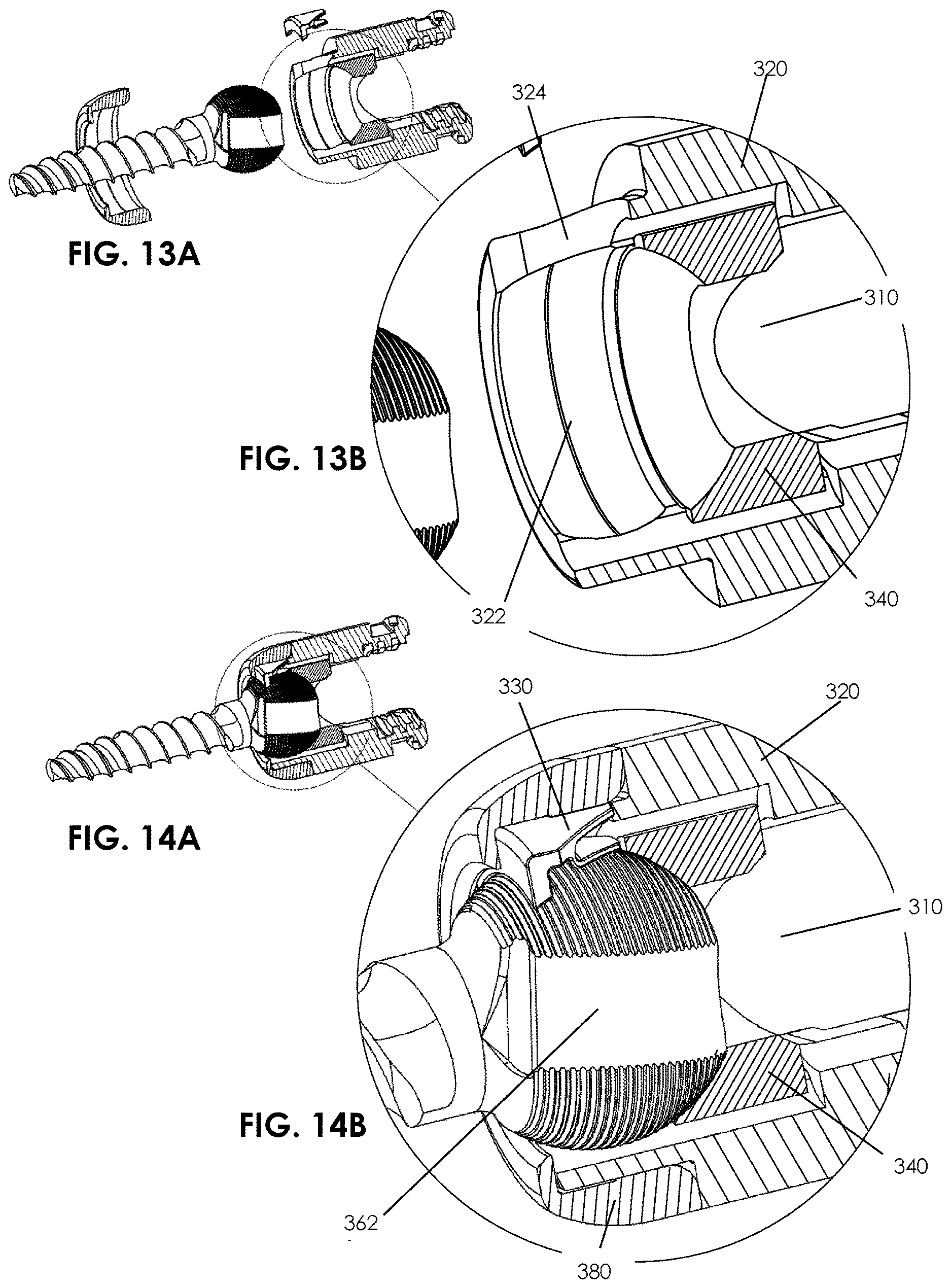 Patent US12611234 Figure 11 – Spinal fixation system