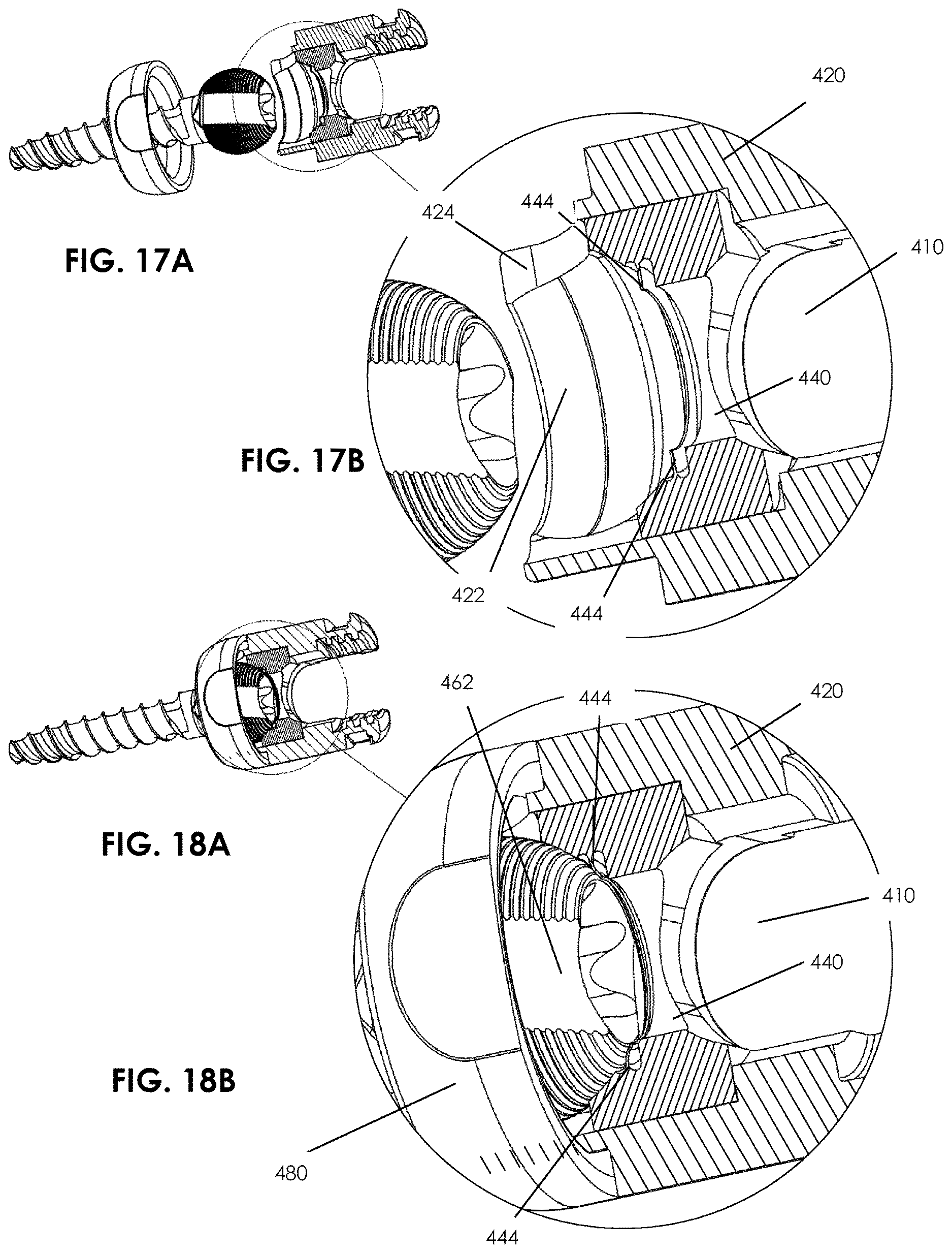 Patent US12611234 Figure 14 – Spinal fixation system