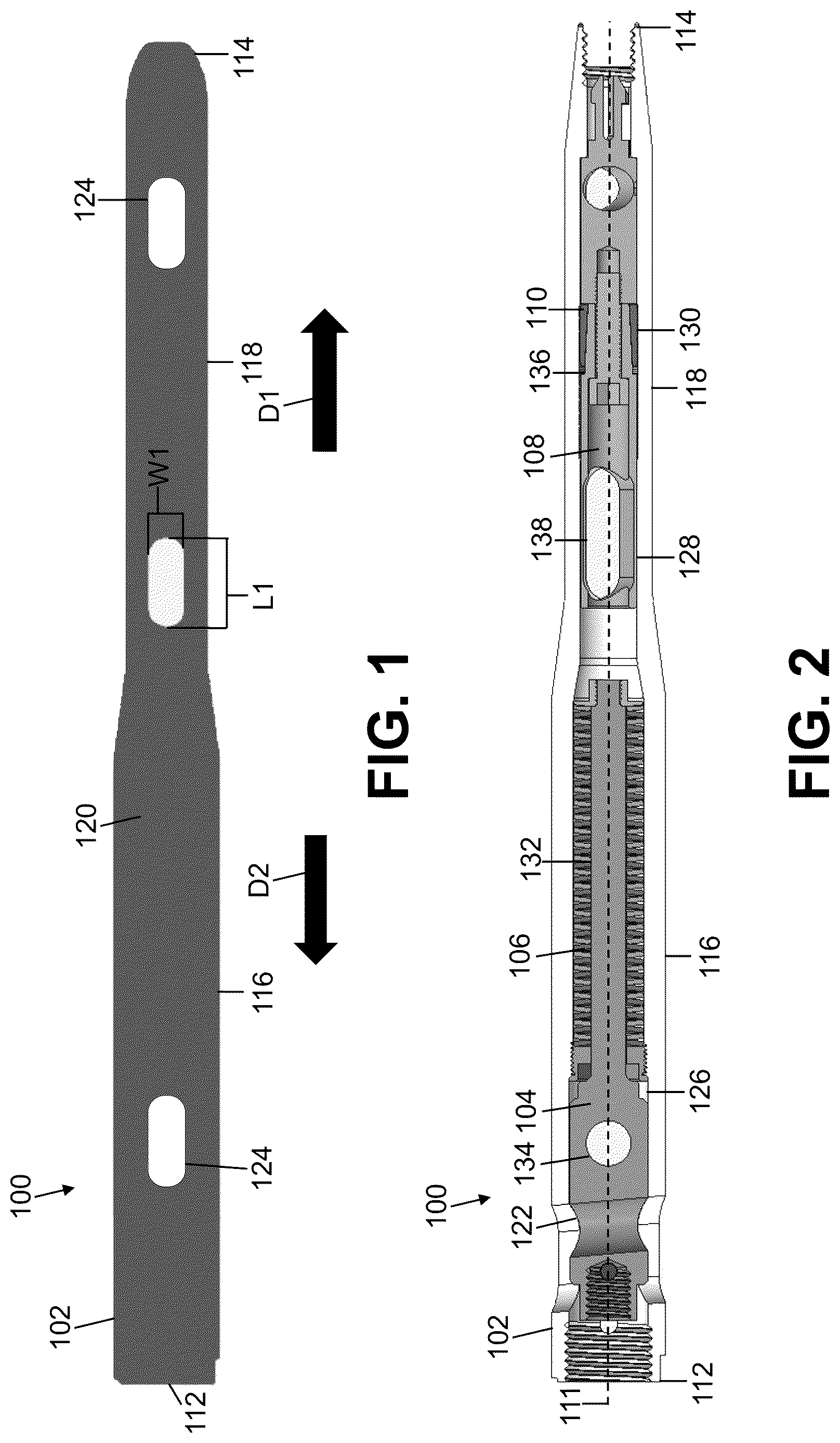 Patent US12611235 Figure 1 – Intramedullary nail with automatic dynamization and continuous compression