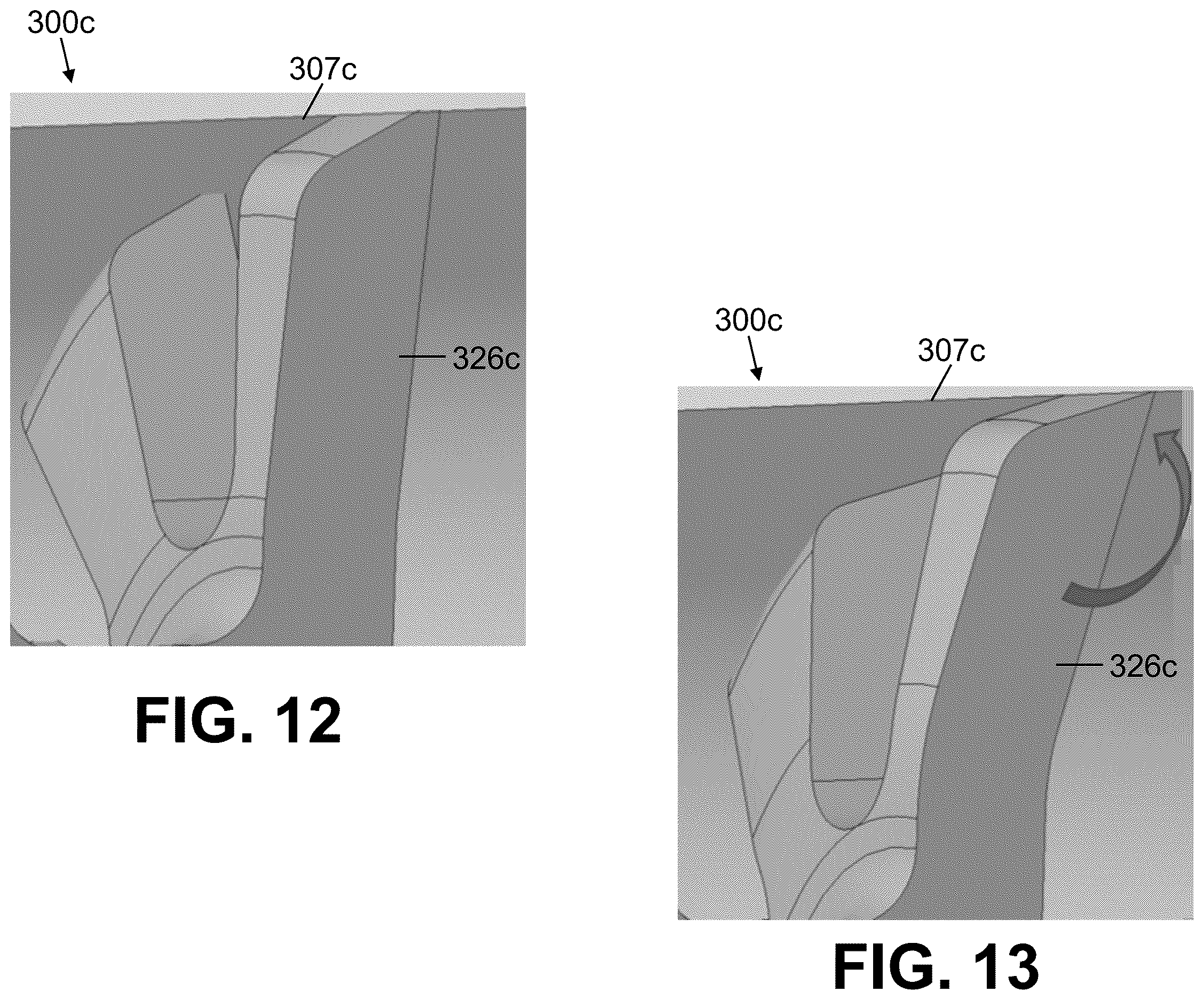 Patent US12611235 Figure 6 – Intramedullary nail with automatic dynamization and continuous compression