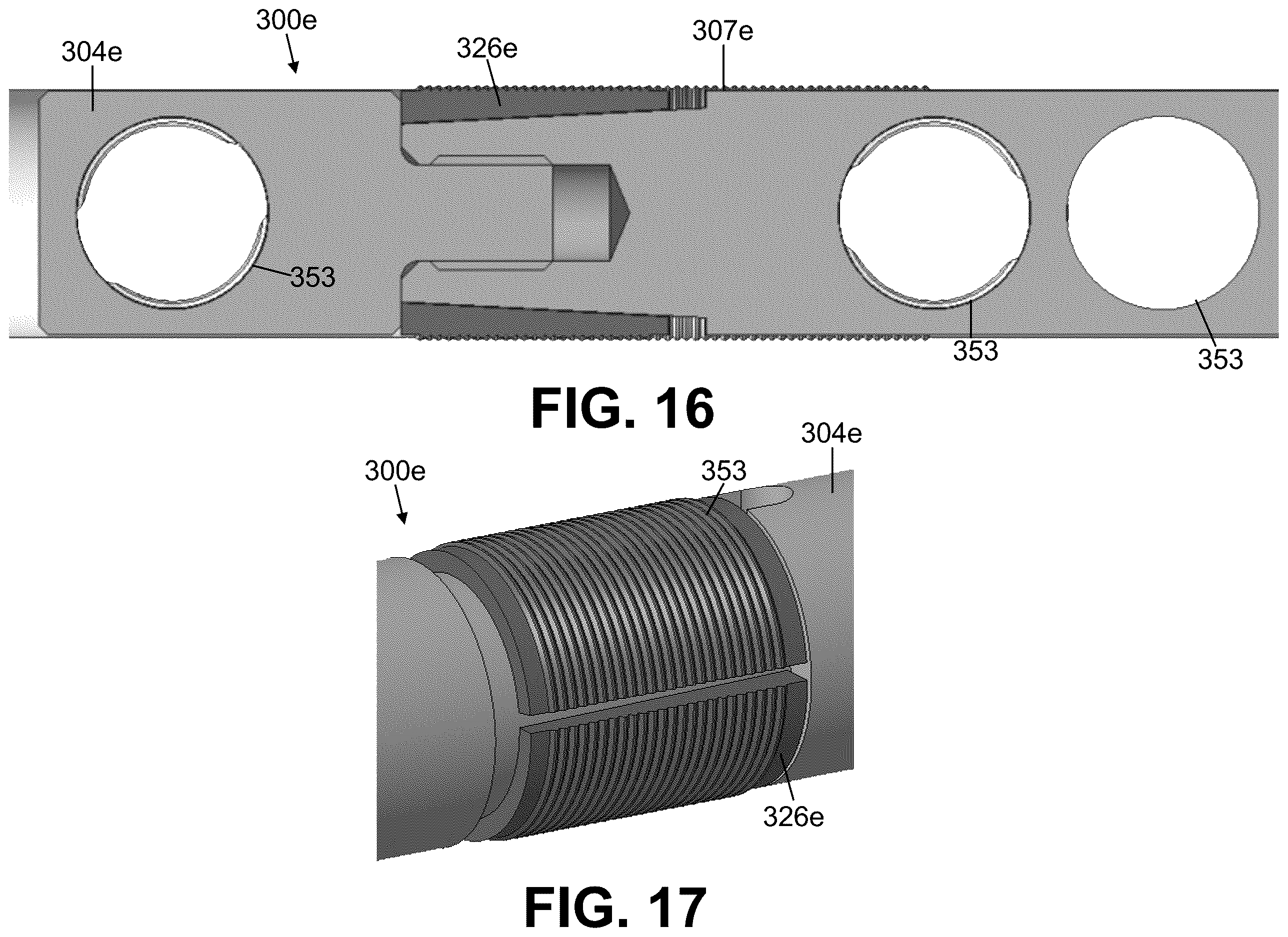 Patent US12611235 Figure 8 – Intramedullary nail with automatic dynamization and continuous compression