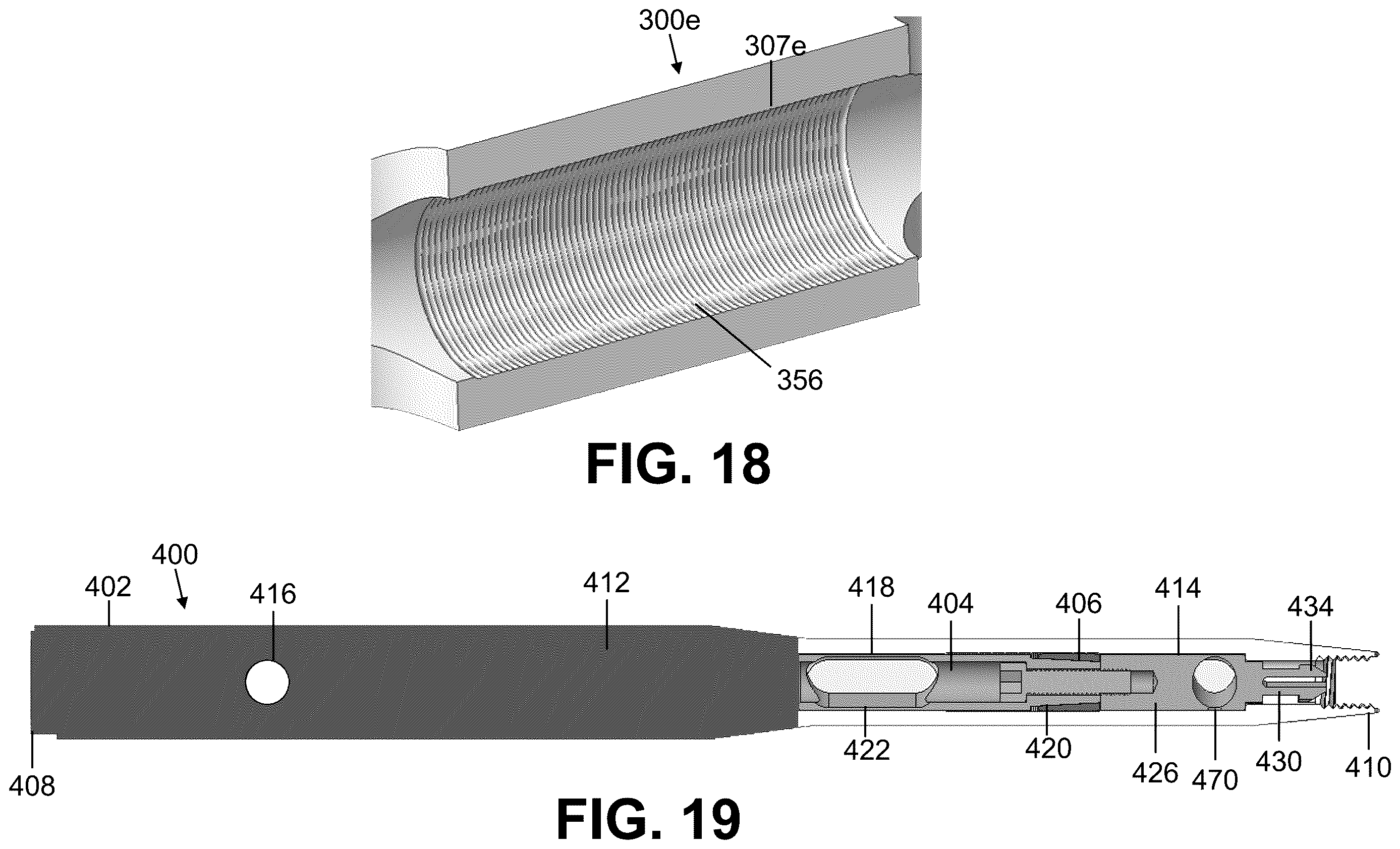 Patent US12611235 Figure 9 – Intramedullary nail with automatic dynamization and continuous compression