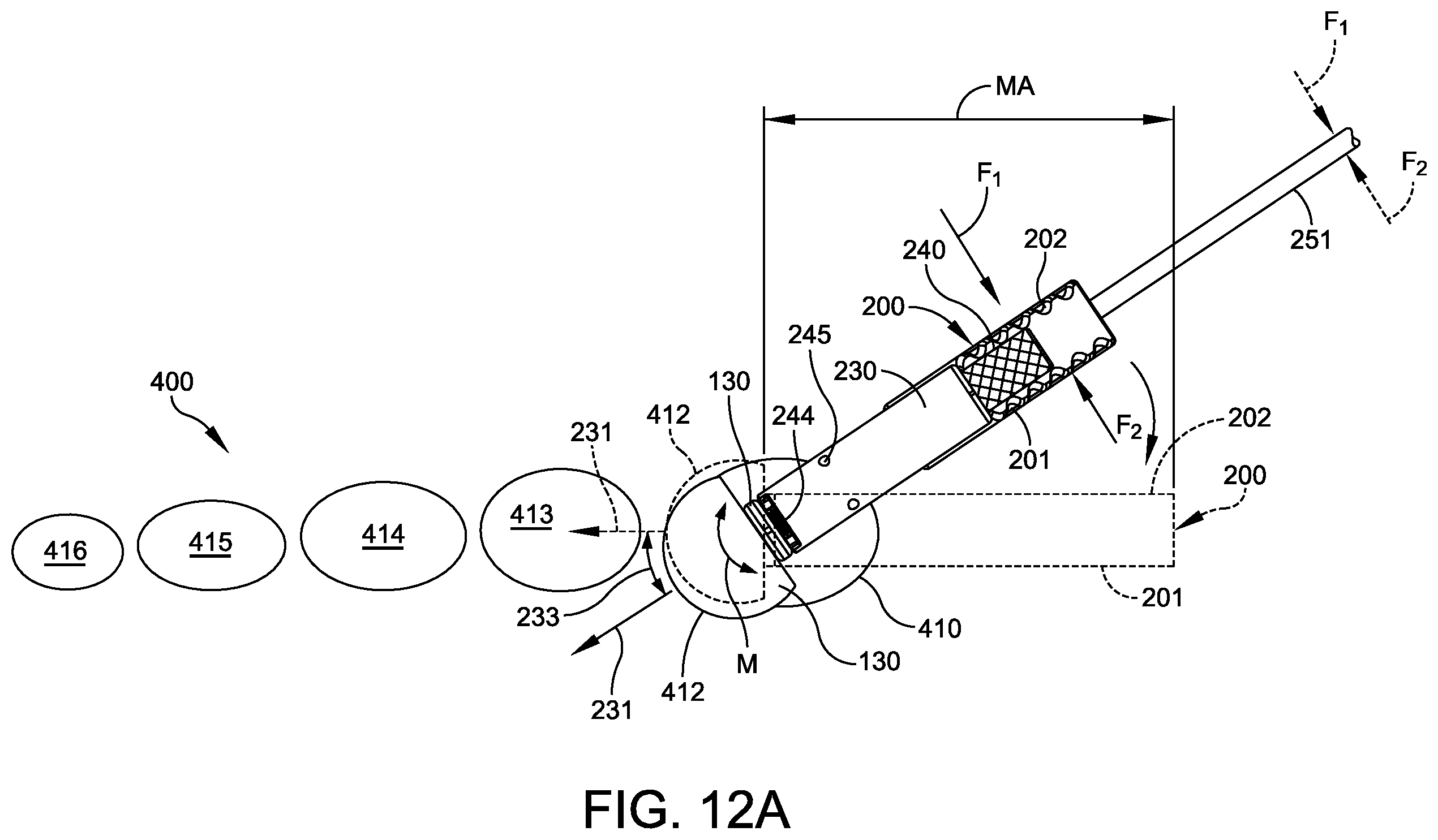 Patent US12611236 Figure 7 – Implant with intramedullary portion and offset extramedullary portion