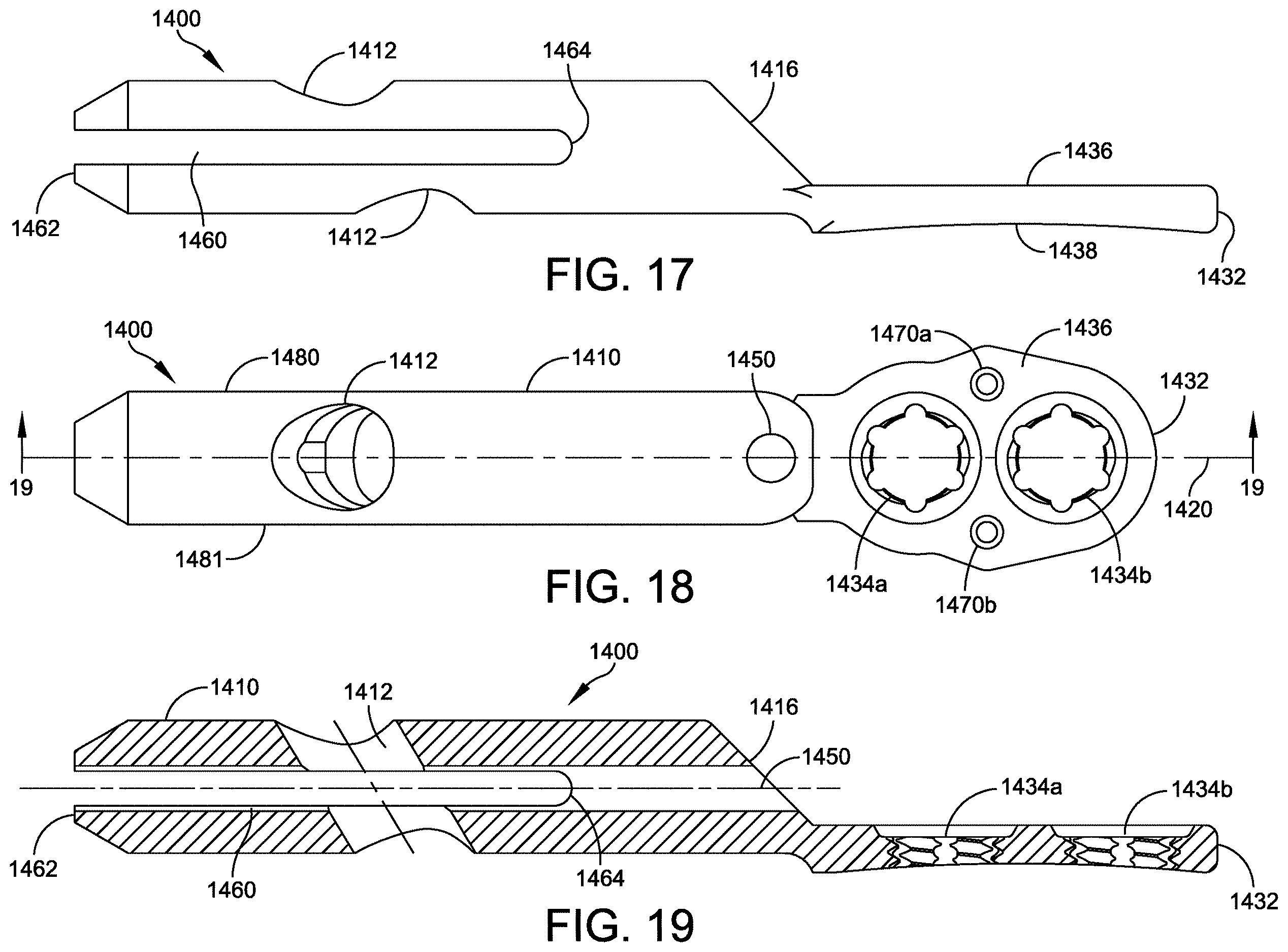 Patent US12611236 Figure 12 – Implant with intramedullary portion and offset extramedullary portion