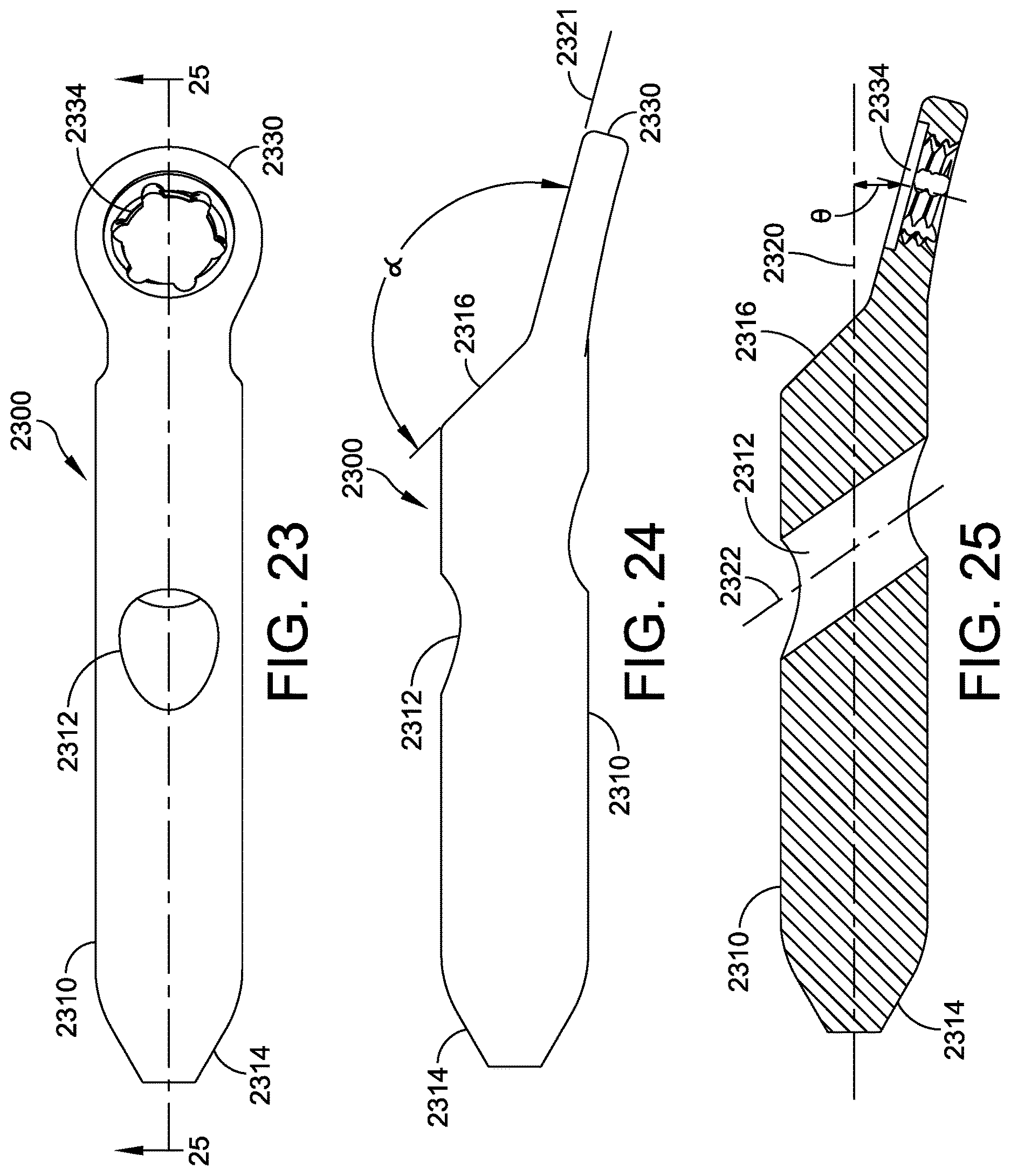 Patent US12611236 Figure 14 – Implant with intramedullary portion and offset extramedullary portion
