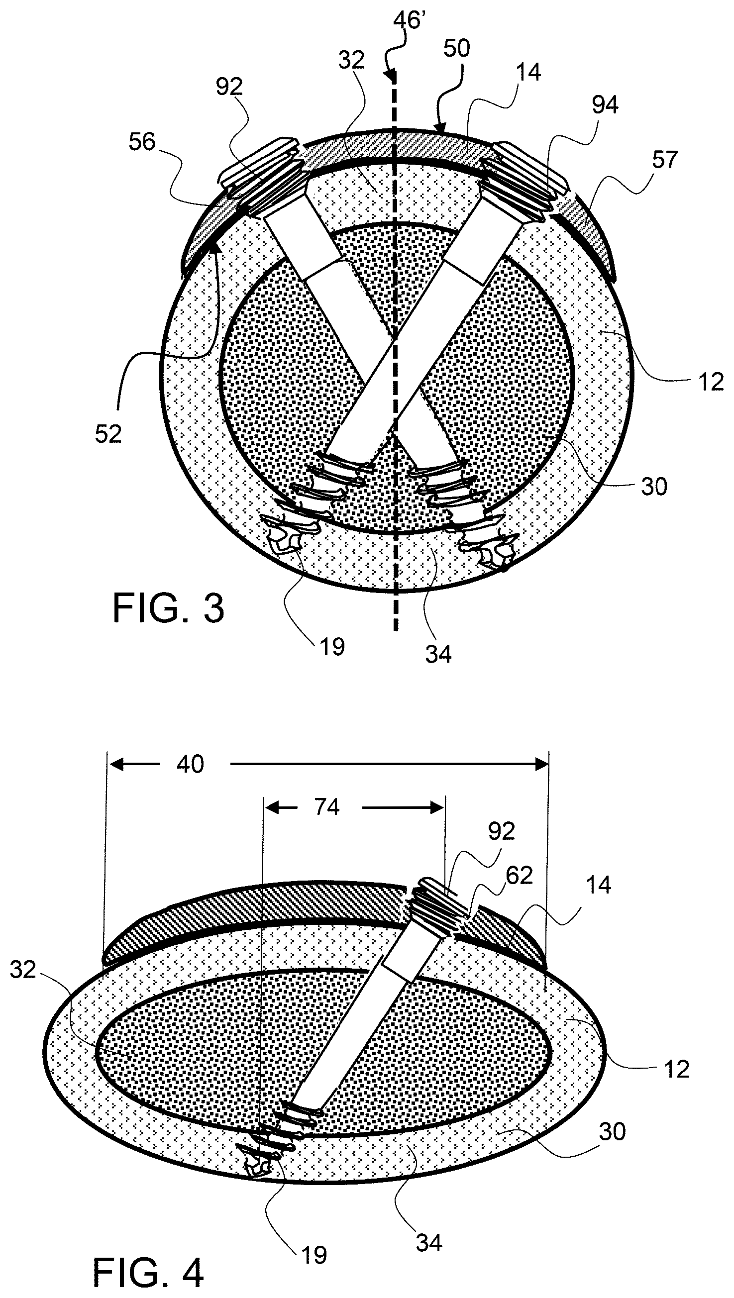 Patent US12611237 Figure 2 – Load sharing bone plate