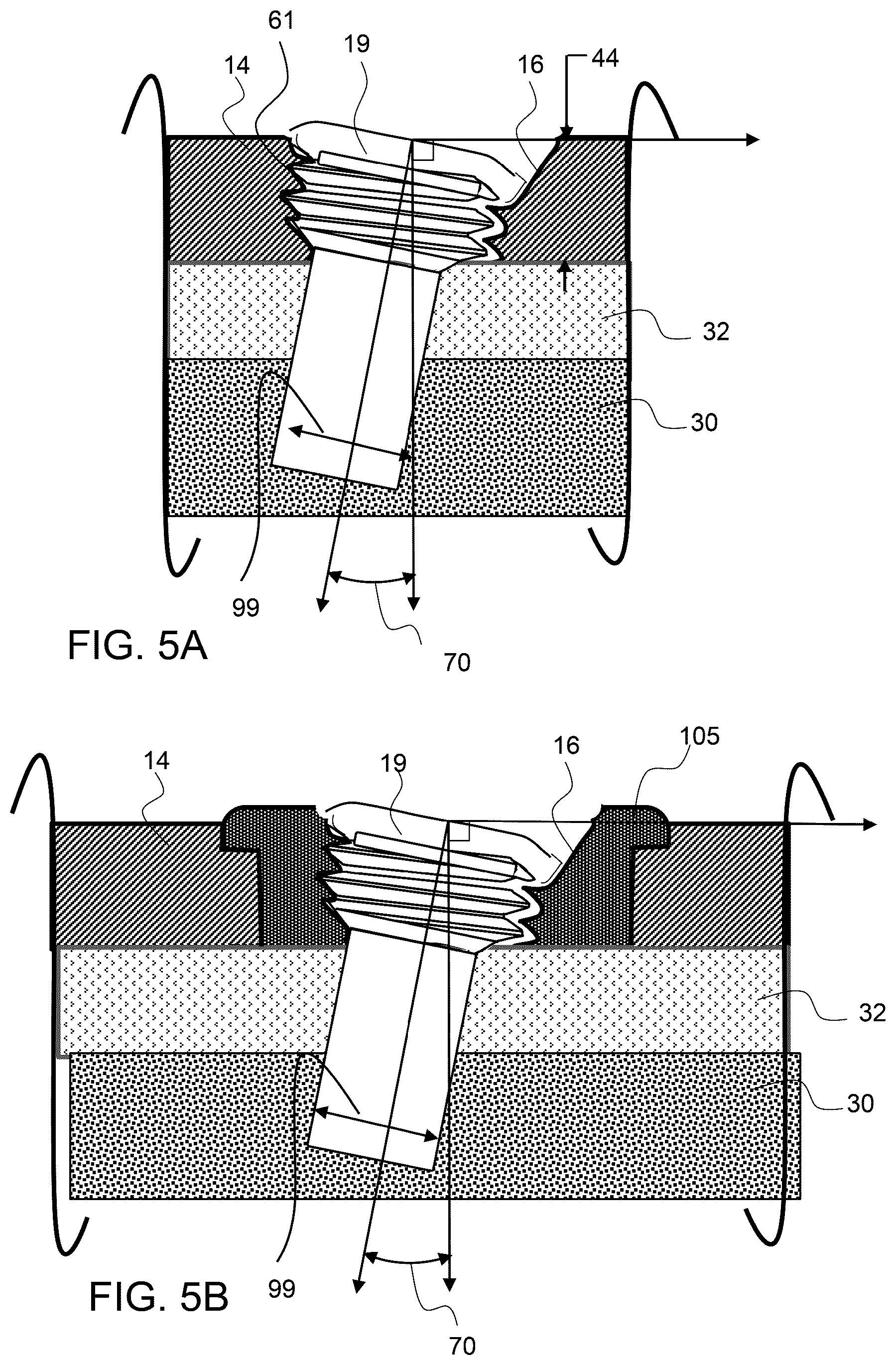 Patent US12611237 Figure 3 – Load sharing bone plate