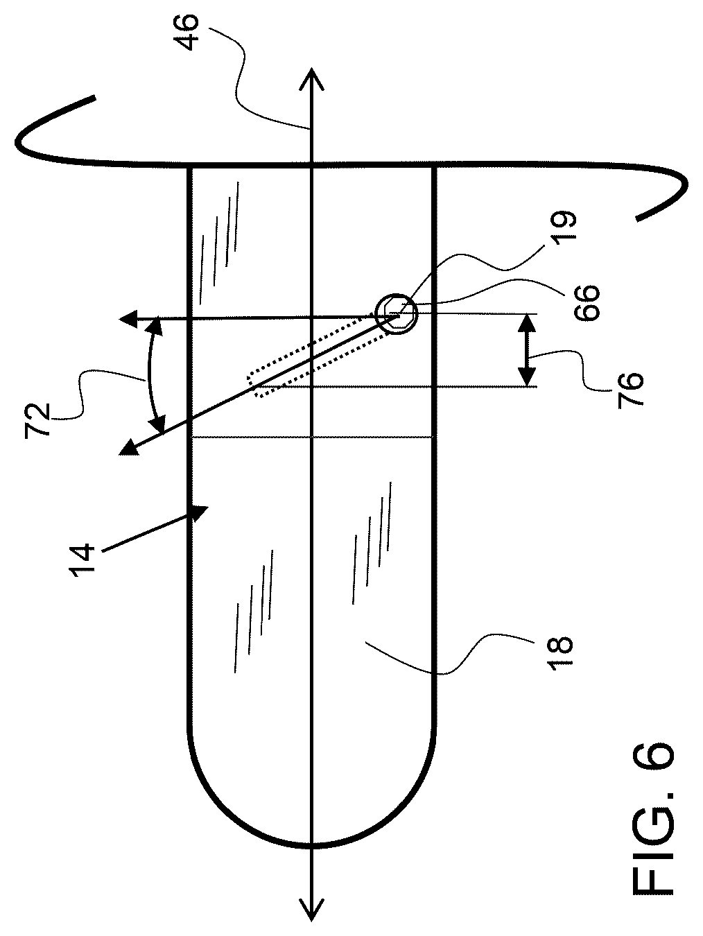 Patent US12611237 Figure 4 – Load sharing bone plate