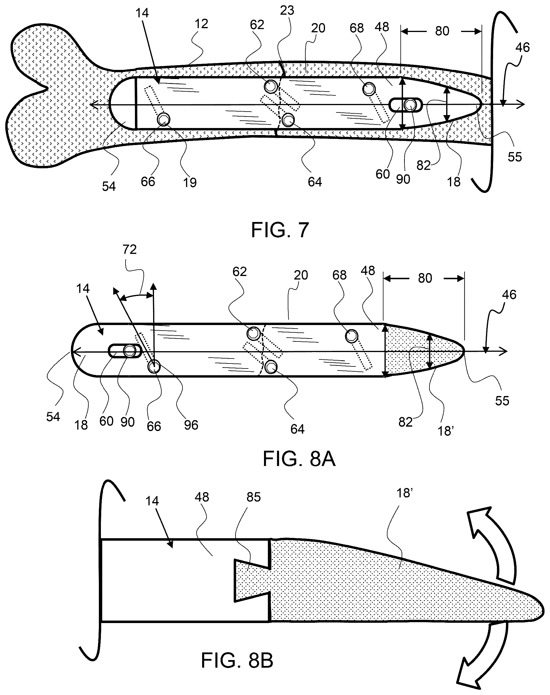 Patent US12611237 Figure 5 – Load sharing bone plate