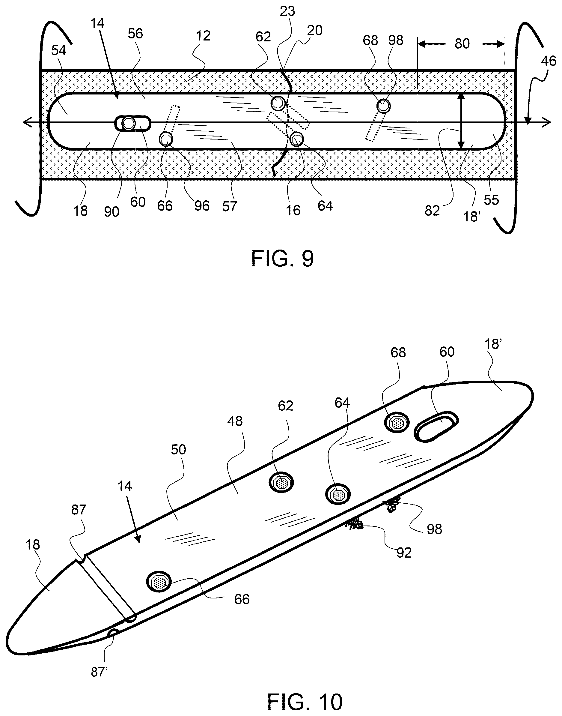 Patent US12611237 Figure 6 – Load sharing bone plate