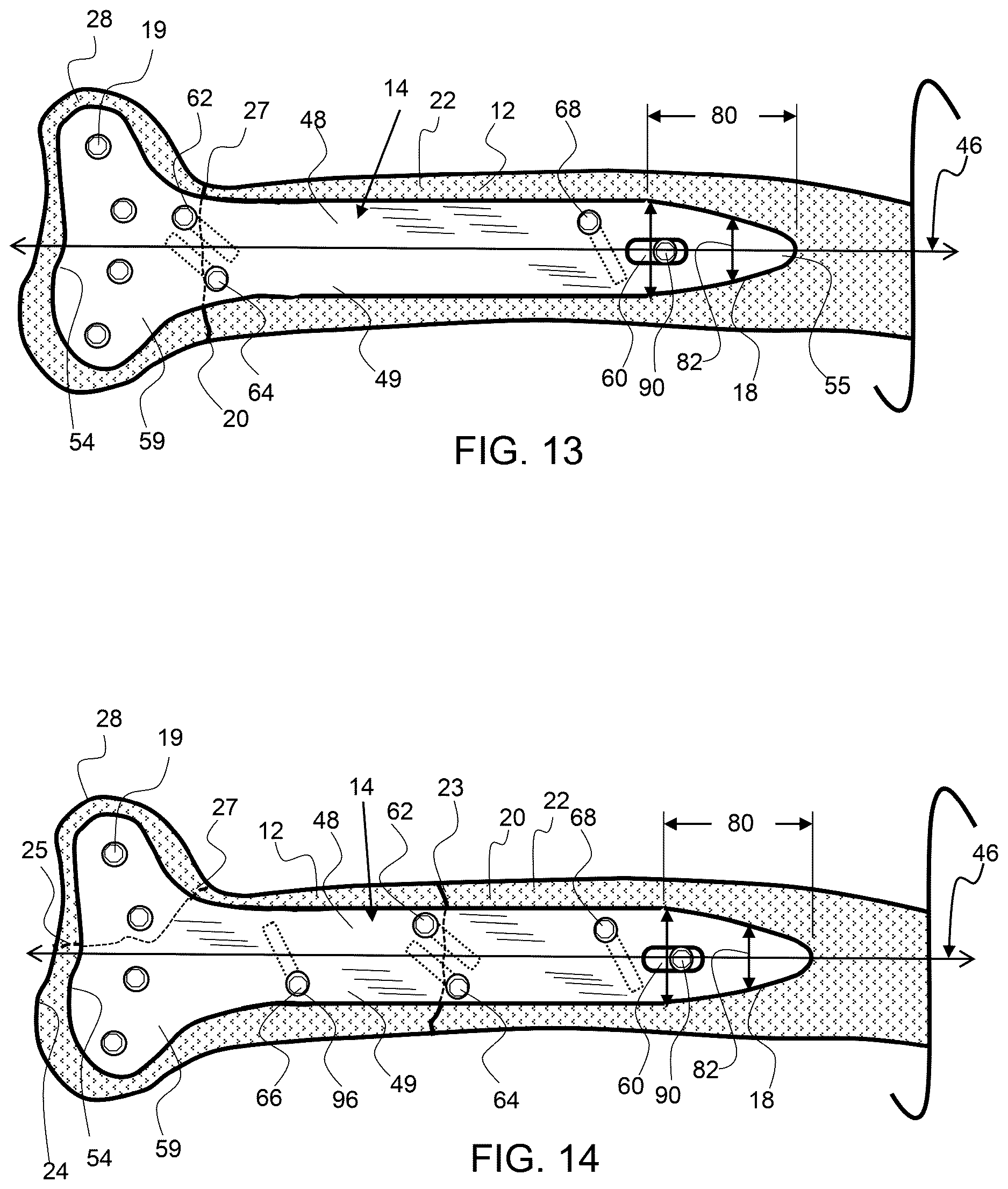 Patent US12611237 Figure 8 – Load sharing bone plate