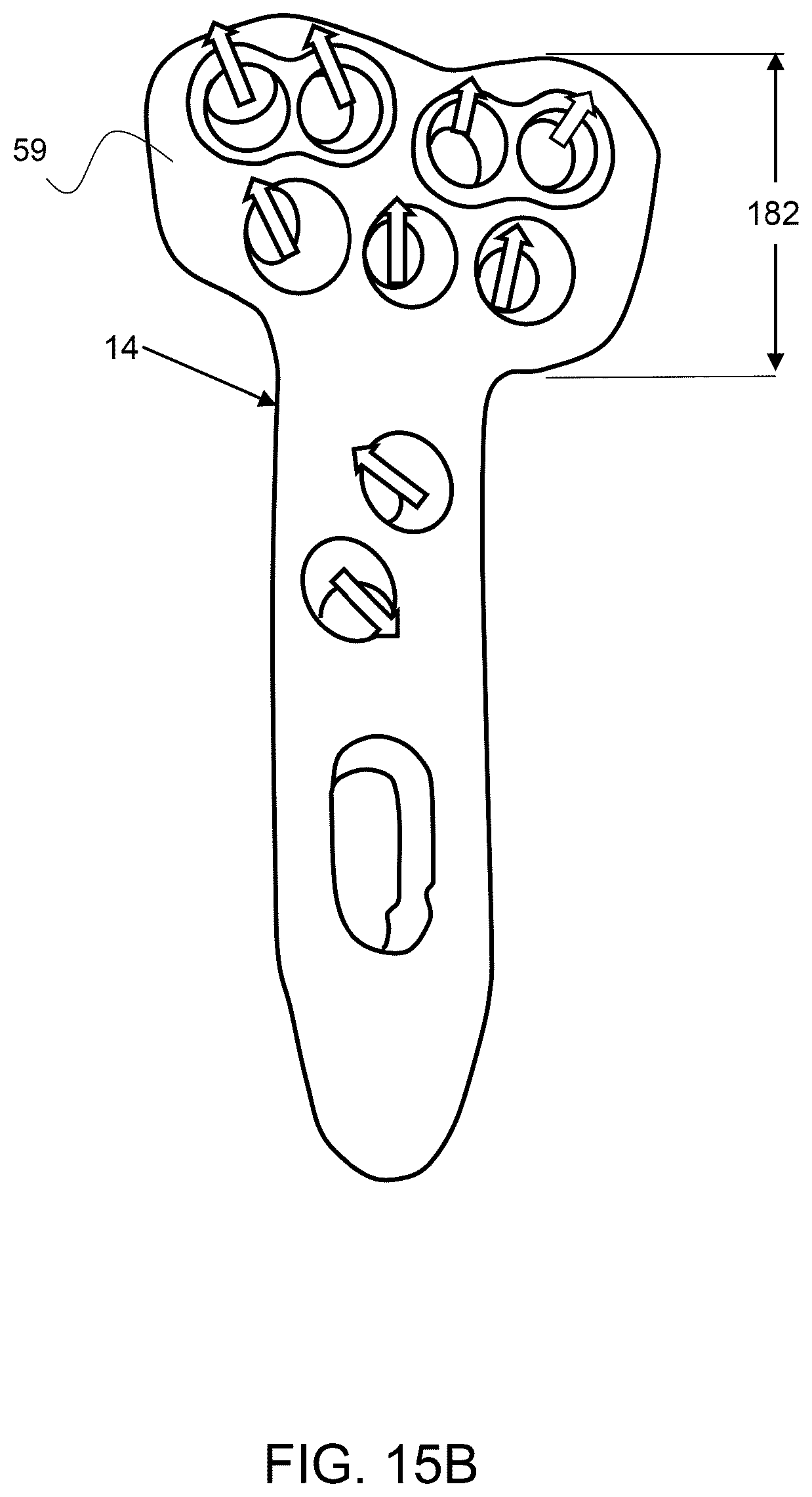Patent US12611237 Figure 10 – Load sharing bone plate