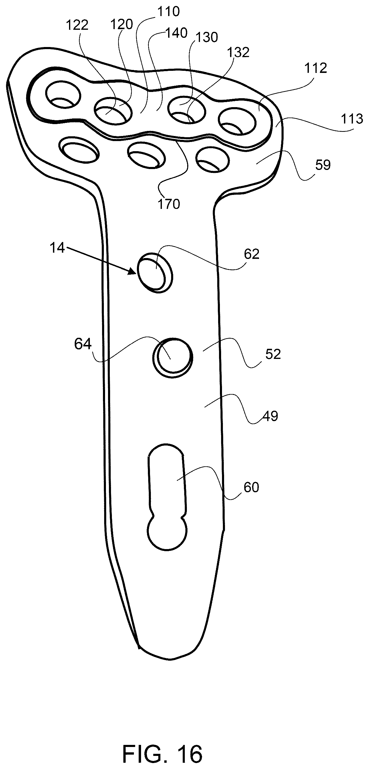 Patent US12611237 Figure 11 – Load sharing bone plate