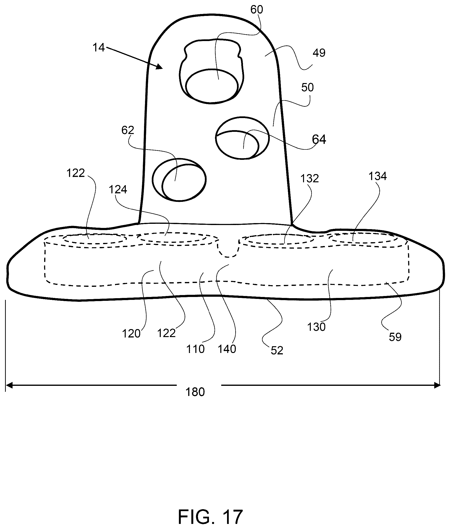 Patent US12611237 Figure 12 – Load sharing bone plate