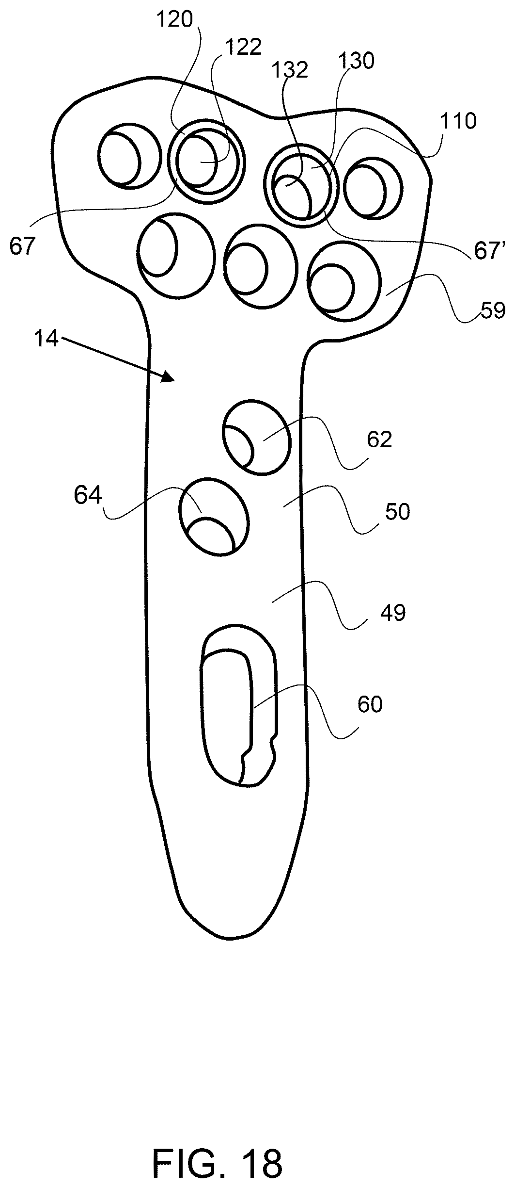 Patent US12611237 Figure 13 – Load sharing bone plate